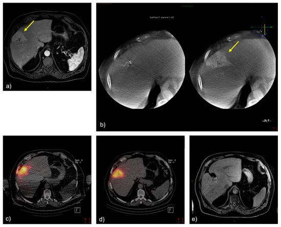 Cancers 15 04791 g002