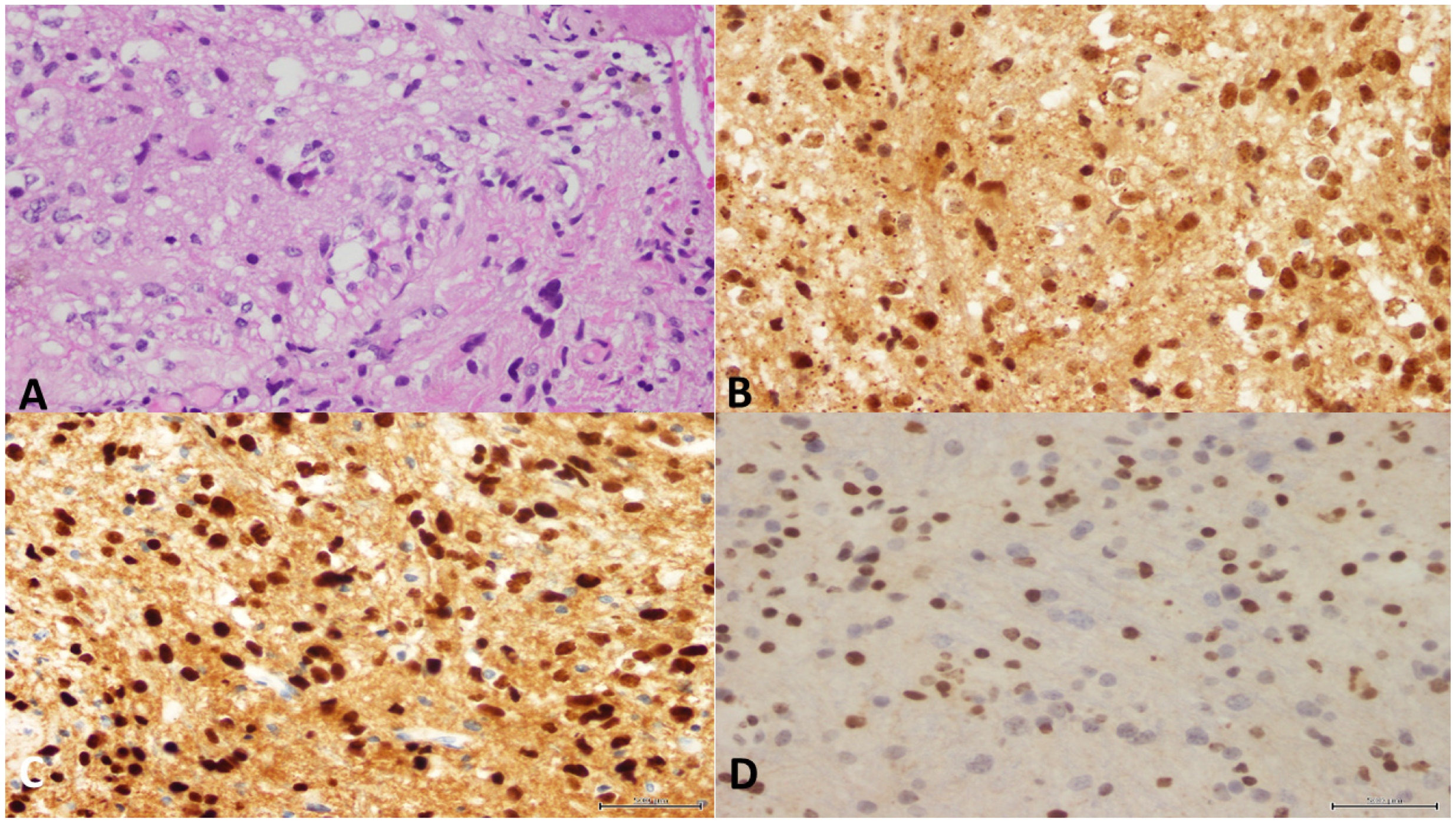 Cancers 15 04869 g005