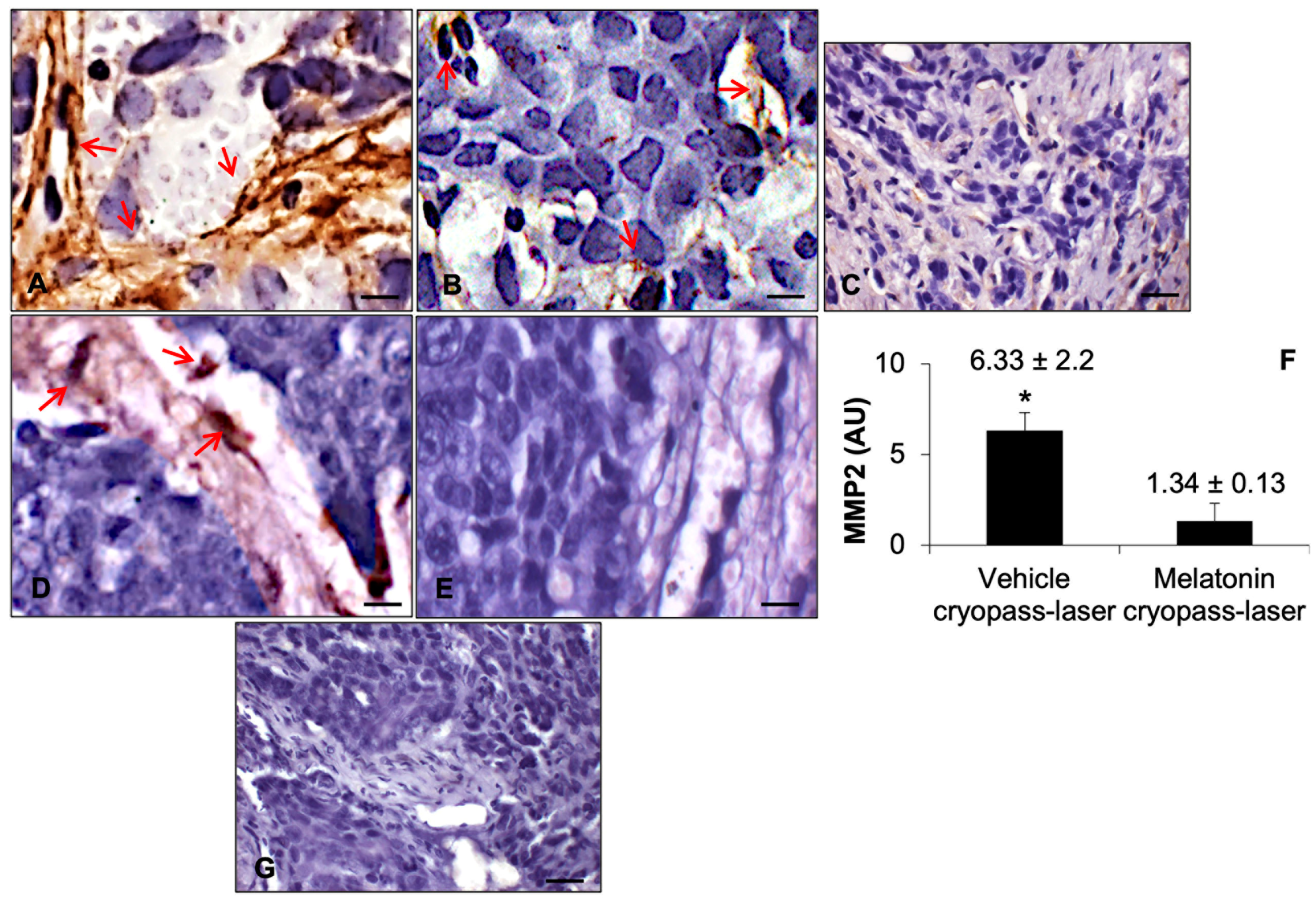 Cancers 15 04908 g004 Cancers 15 04908 g004