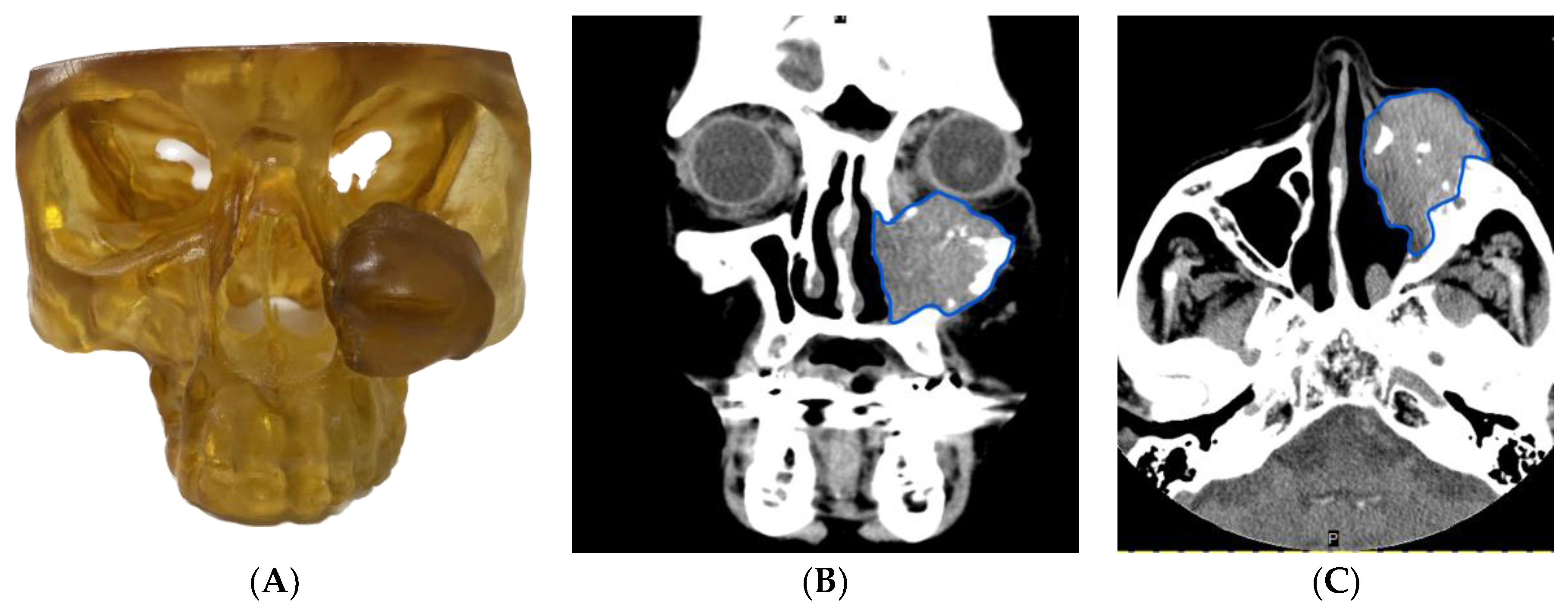 Cancers 15 04989 g004