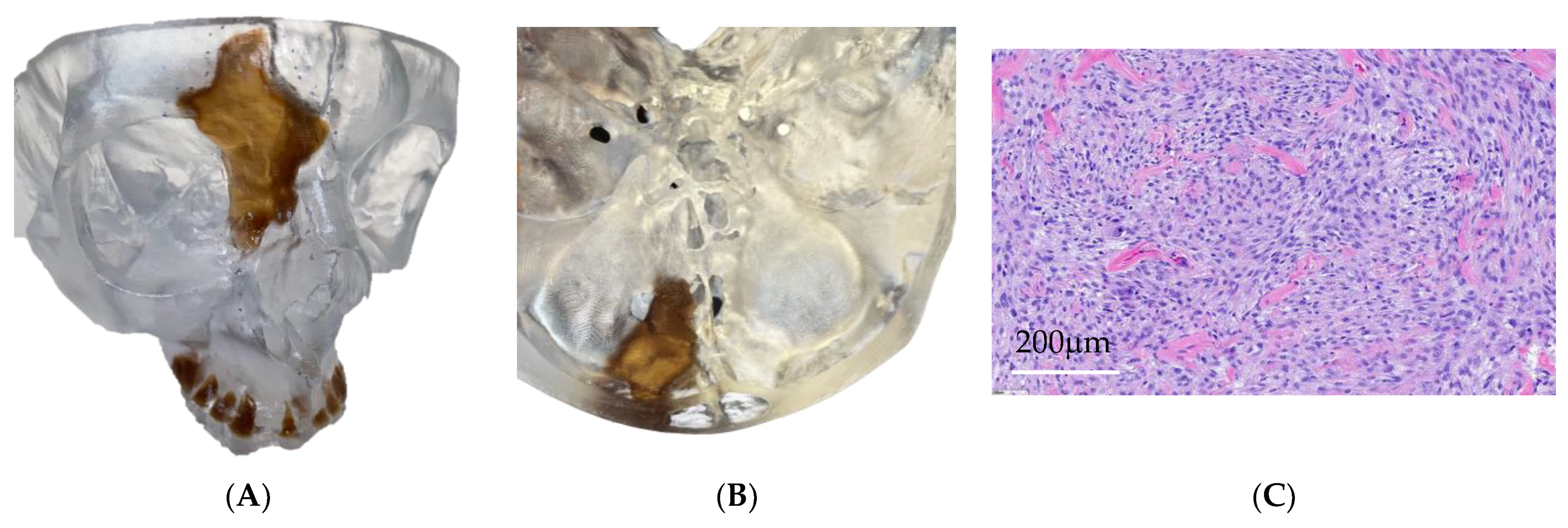 Cancers 15 04989 g005