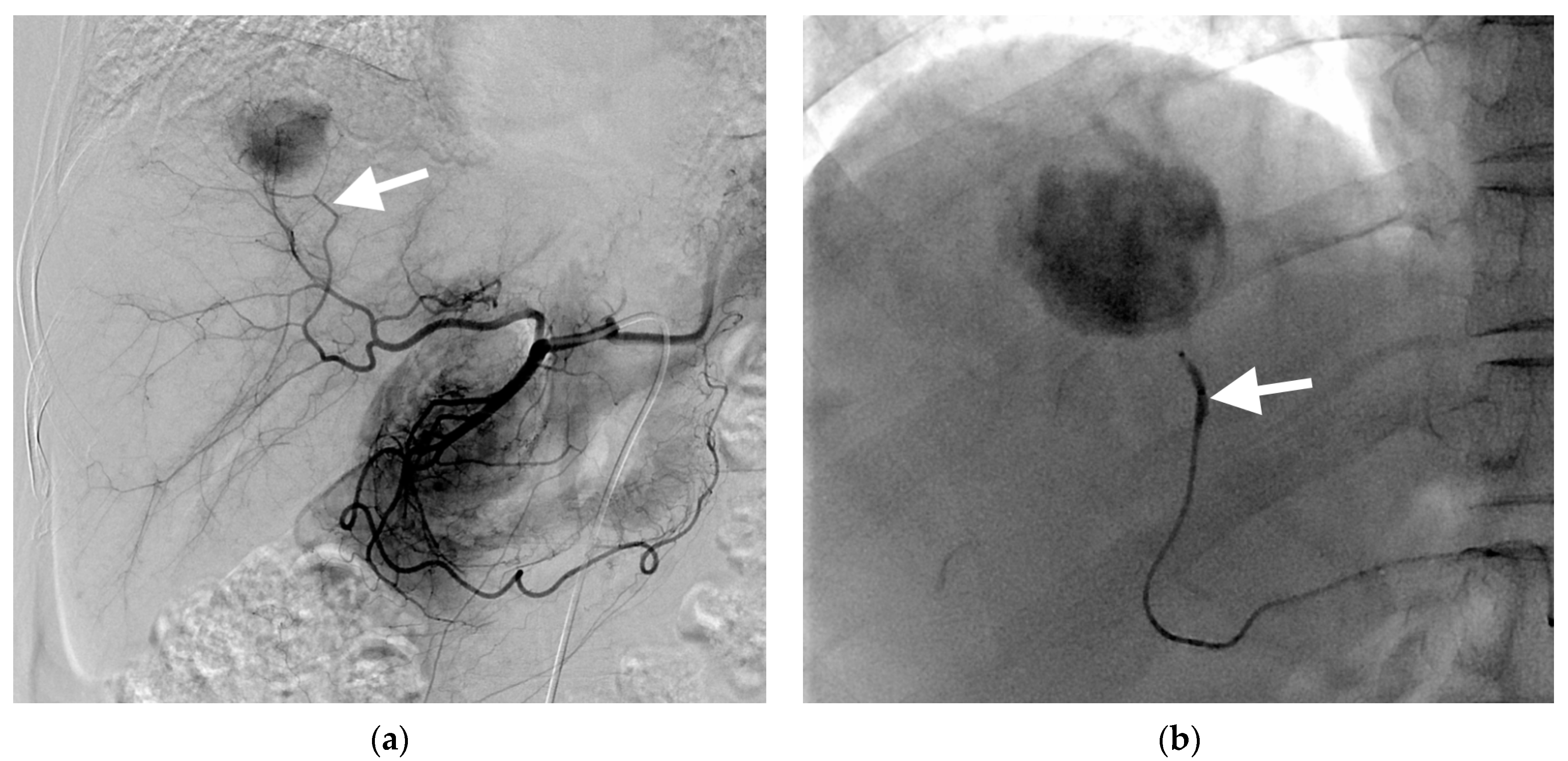 Cancers 15 04991 g001a