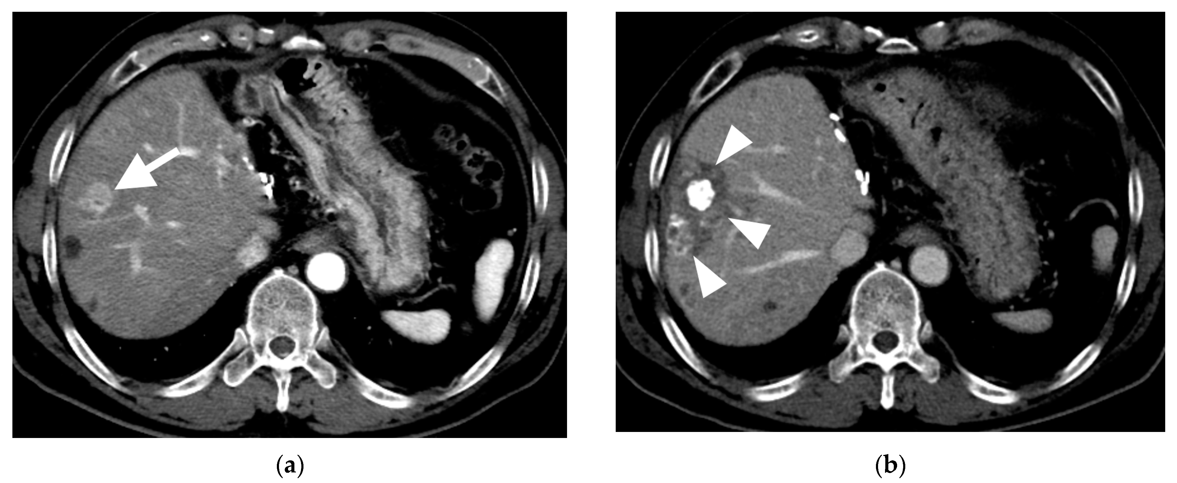 Cancers 15 04991 g004a