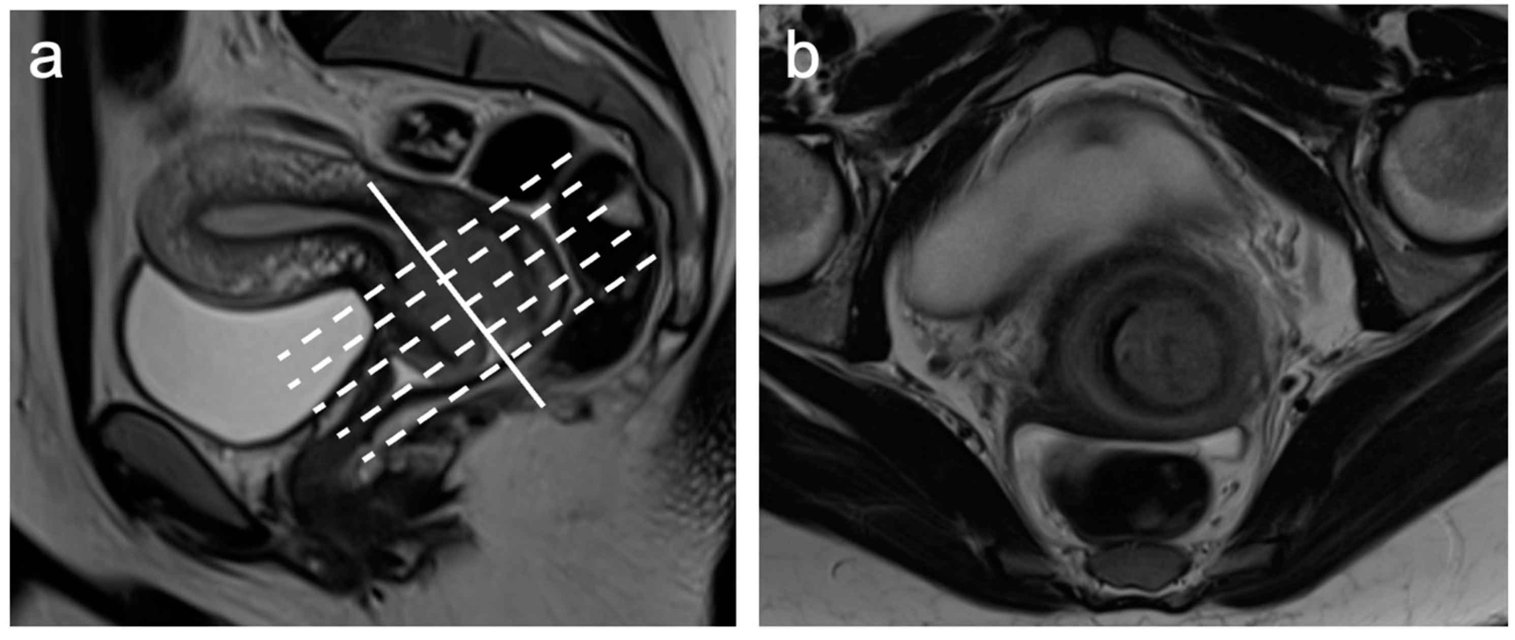 Cancers 15 05105 g001