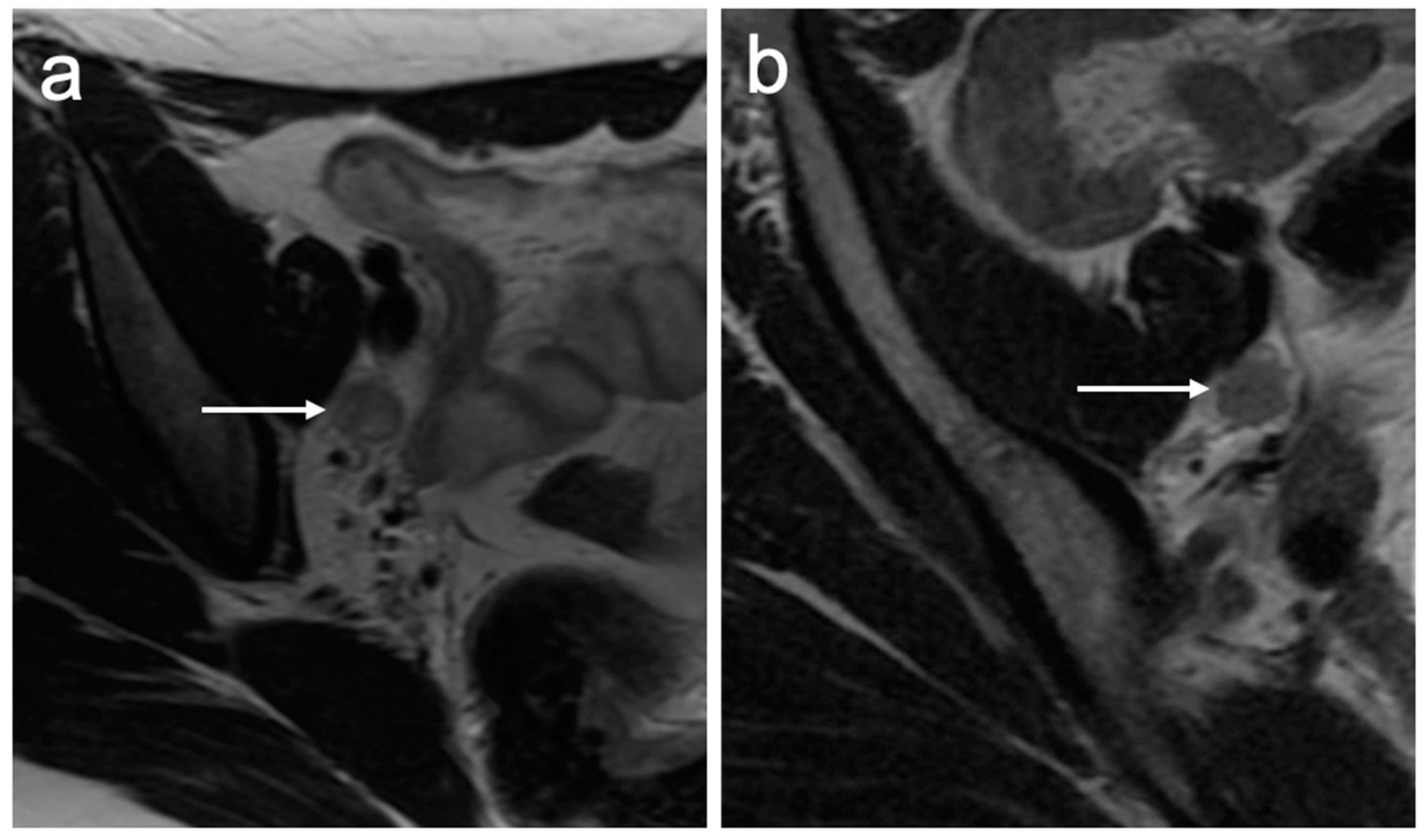 Cancers 15 05105 g002