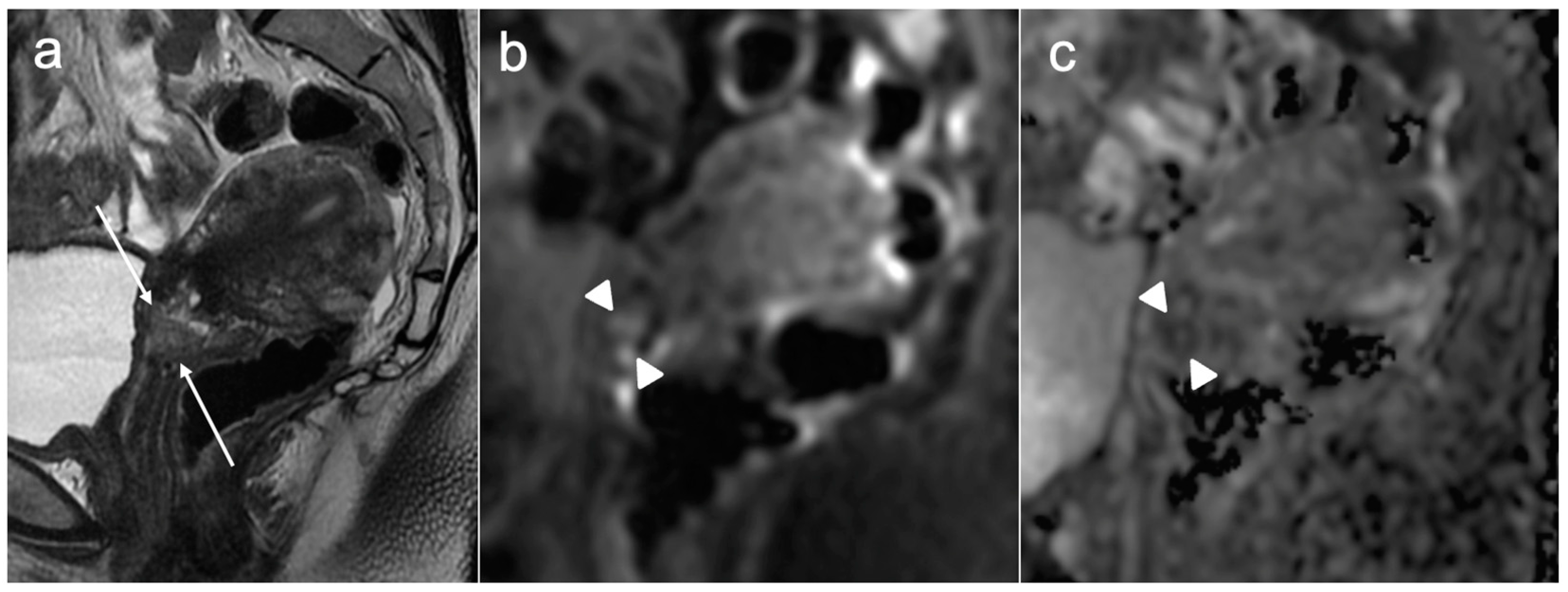 Cancers 15 05105 g003