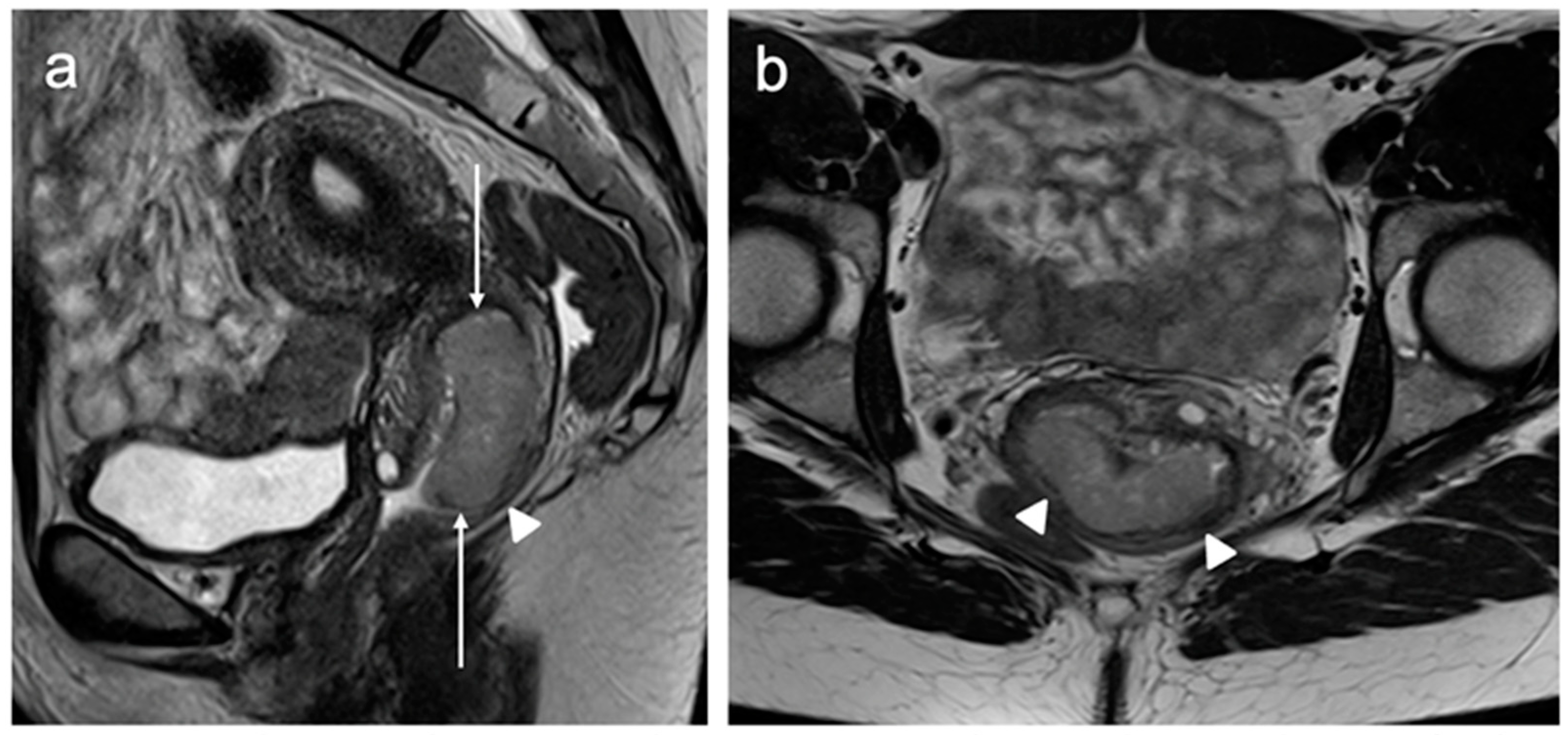 Cancers 15 05105 g005