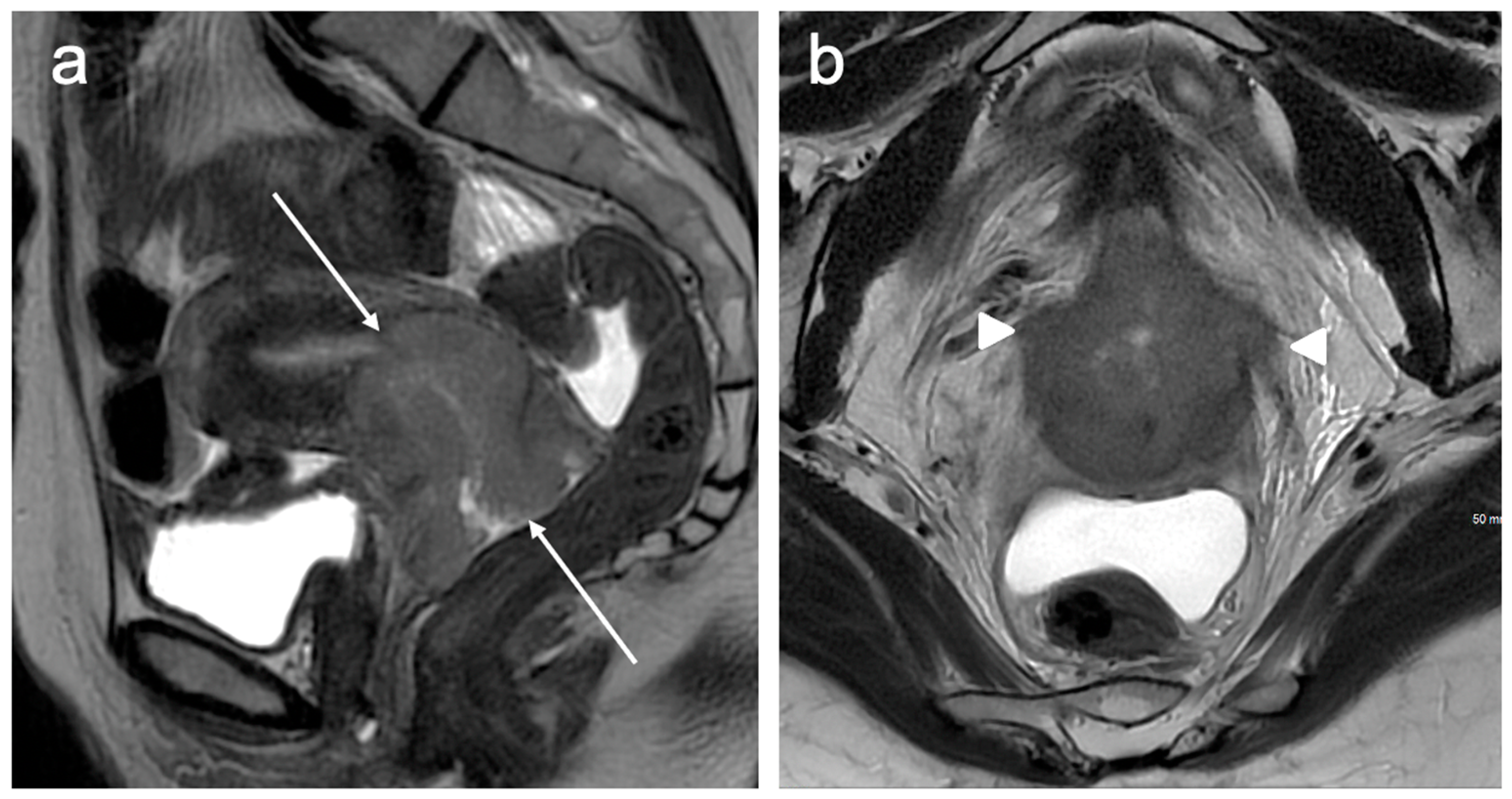 Cancers 15 05105 g006