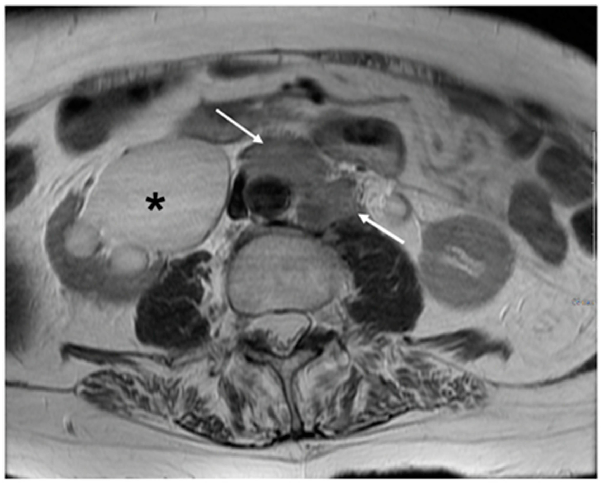 Cancers 15 05105 g010