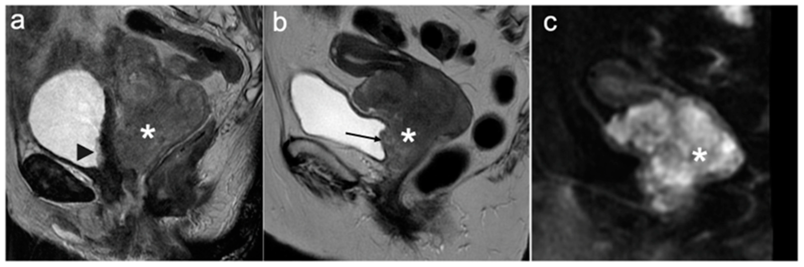 Cancers 15 05105 g011