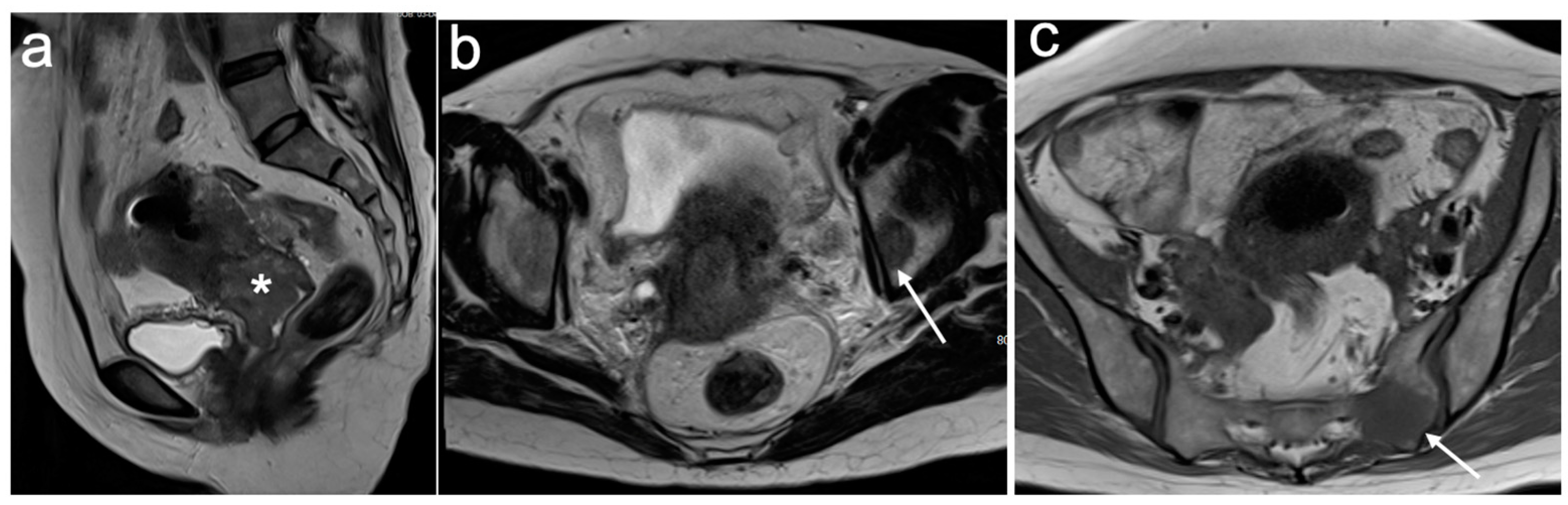 Cancers 15 05105 g012