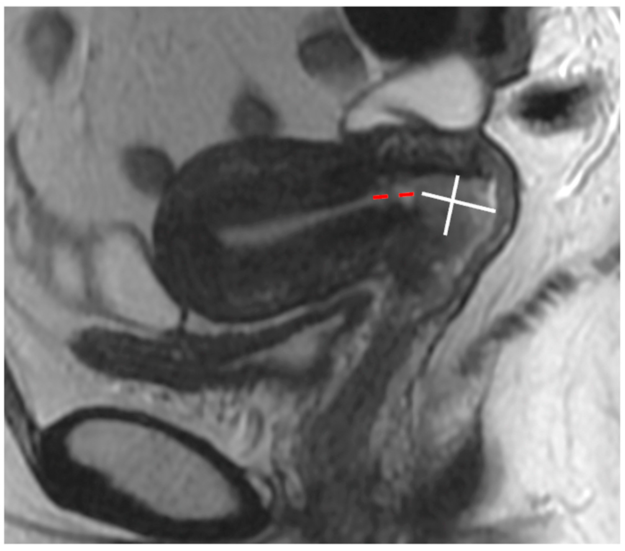 Cancers 15 05105 g013