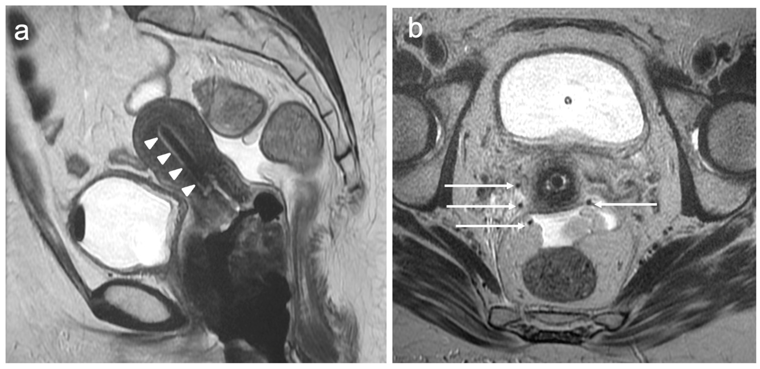 Cancers 15 05105 g014