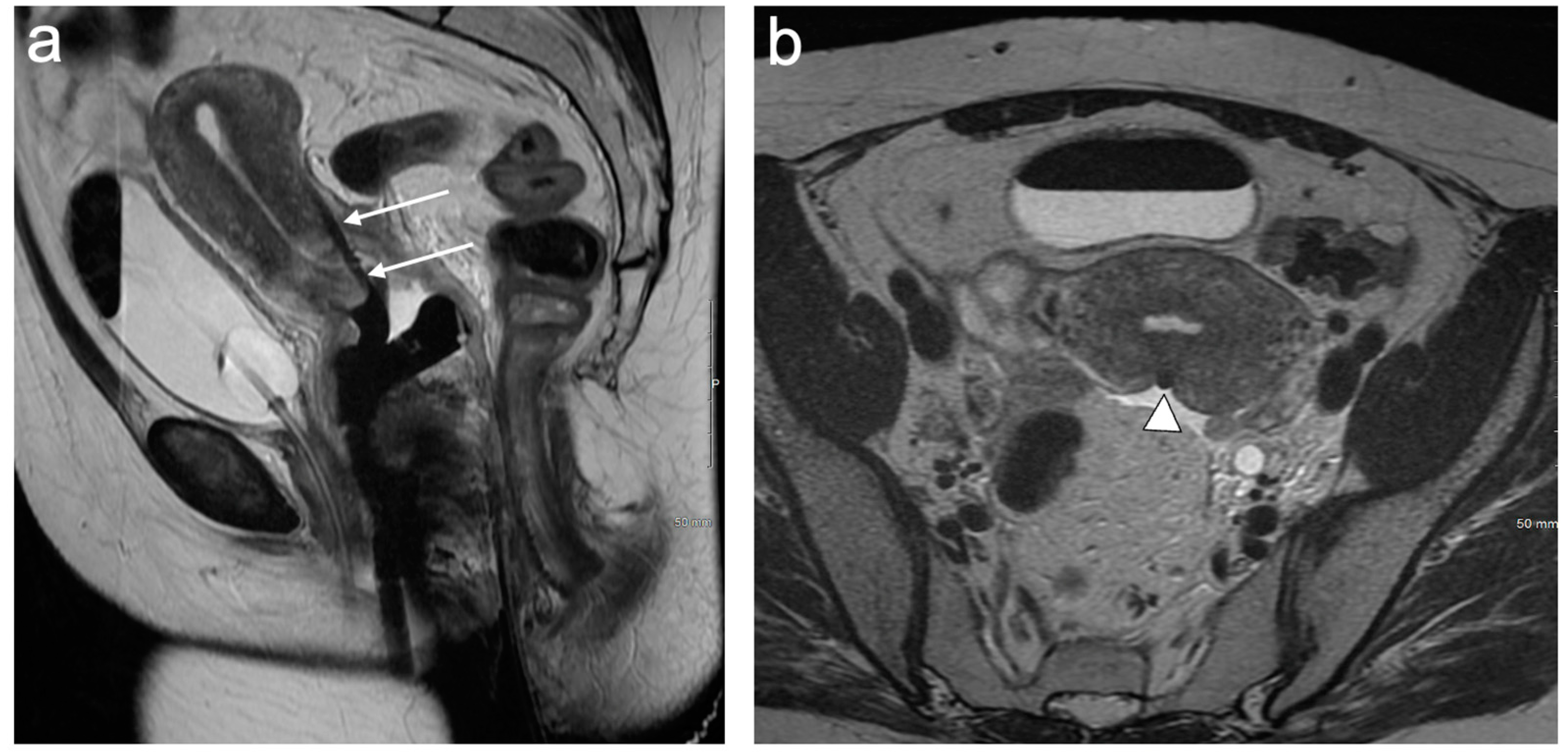 Cancers 15 05105 g015