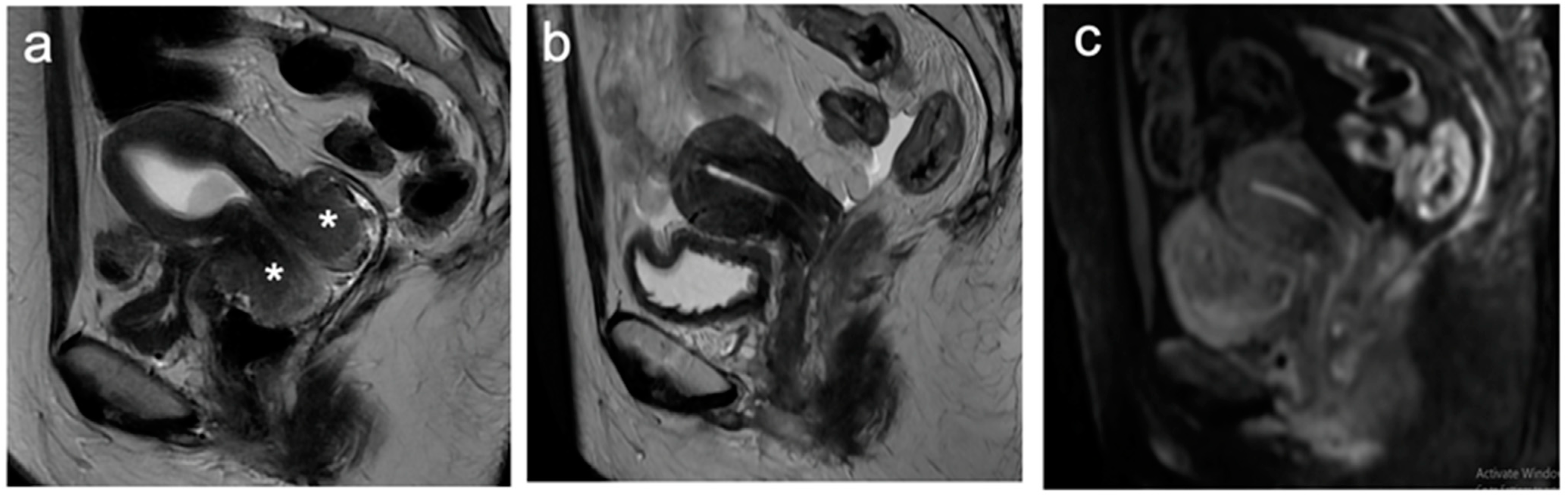 Cancers 15 05105 g017