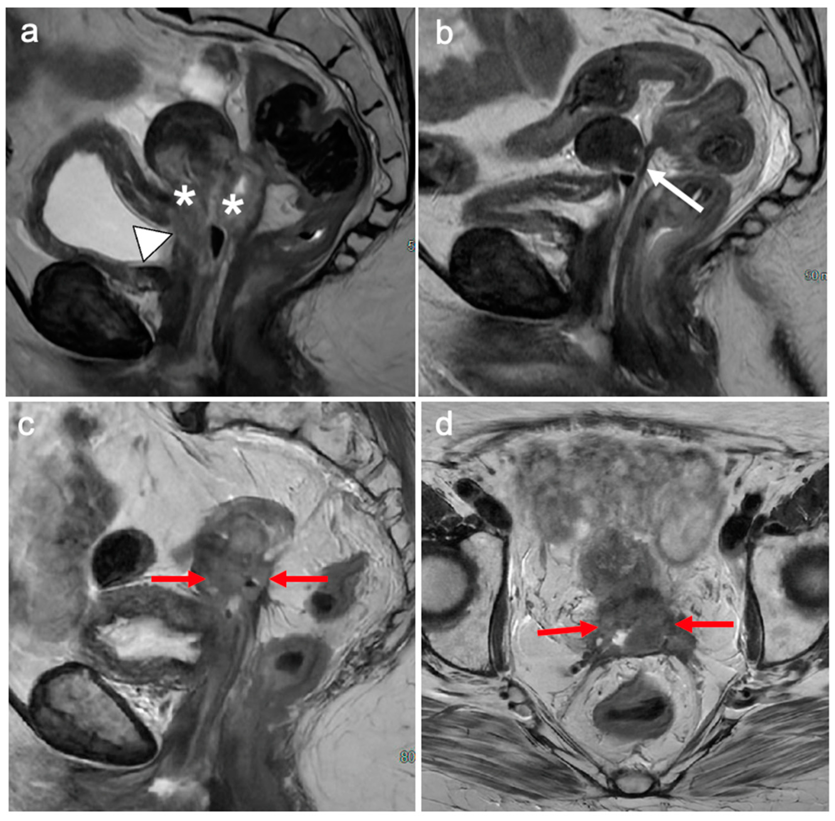 Cancers 15 05105 g018