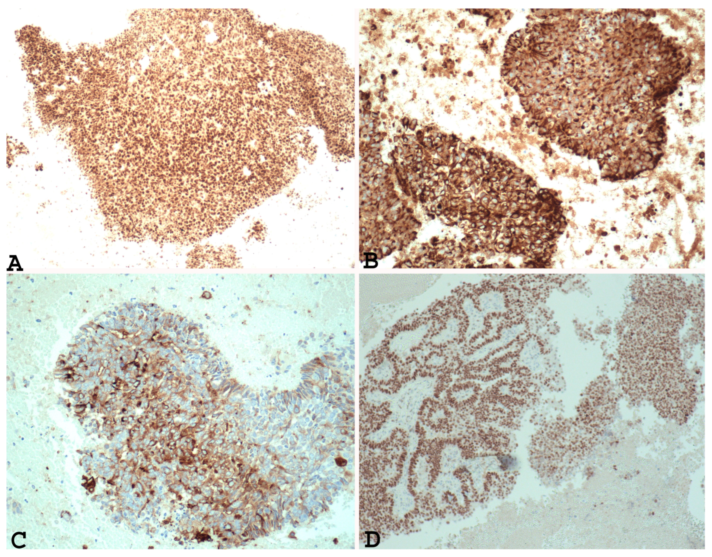 Cancers 15 05155 g001 Cancers 15 05155 g001