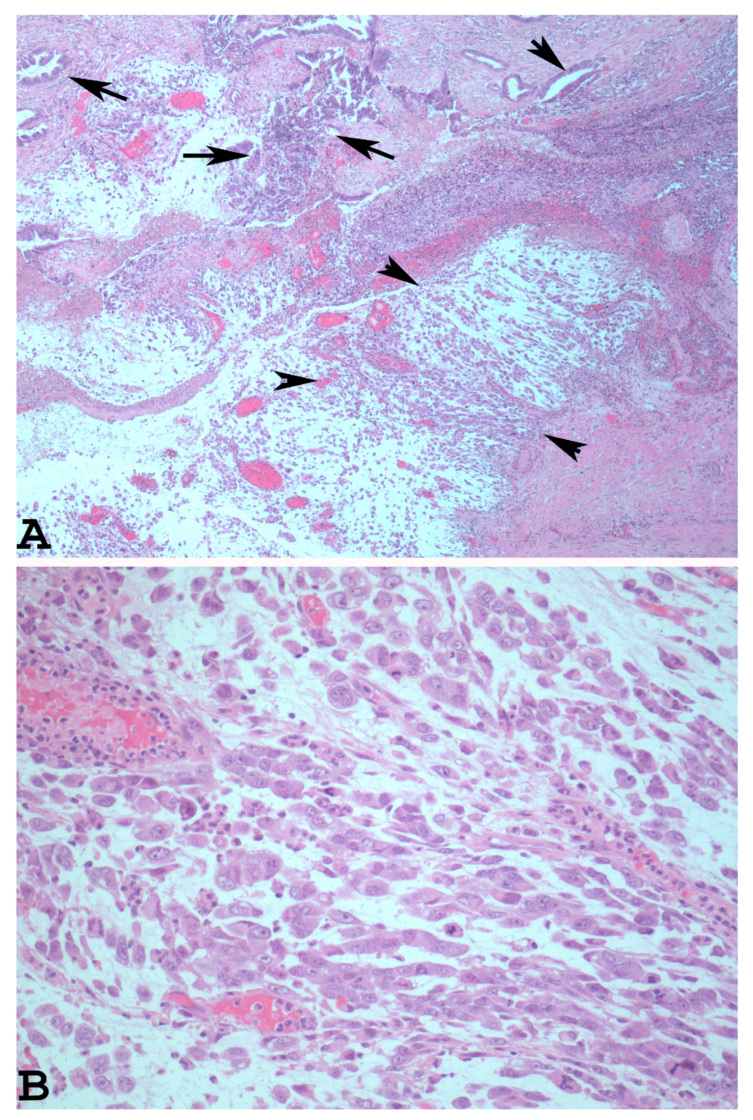 Cancers 15 05155 g002 Cancers 15 05155 g002