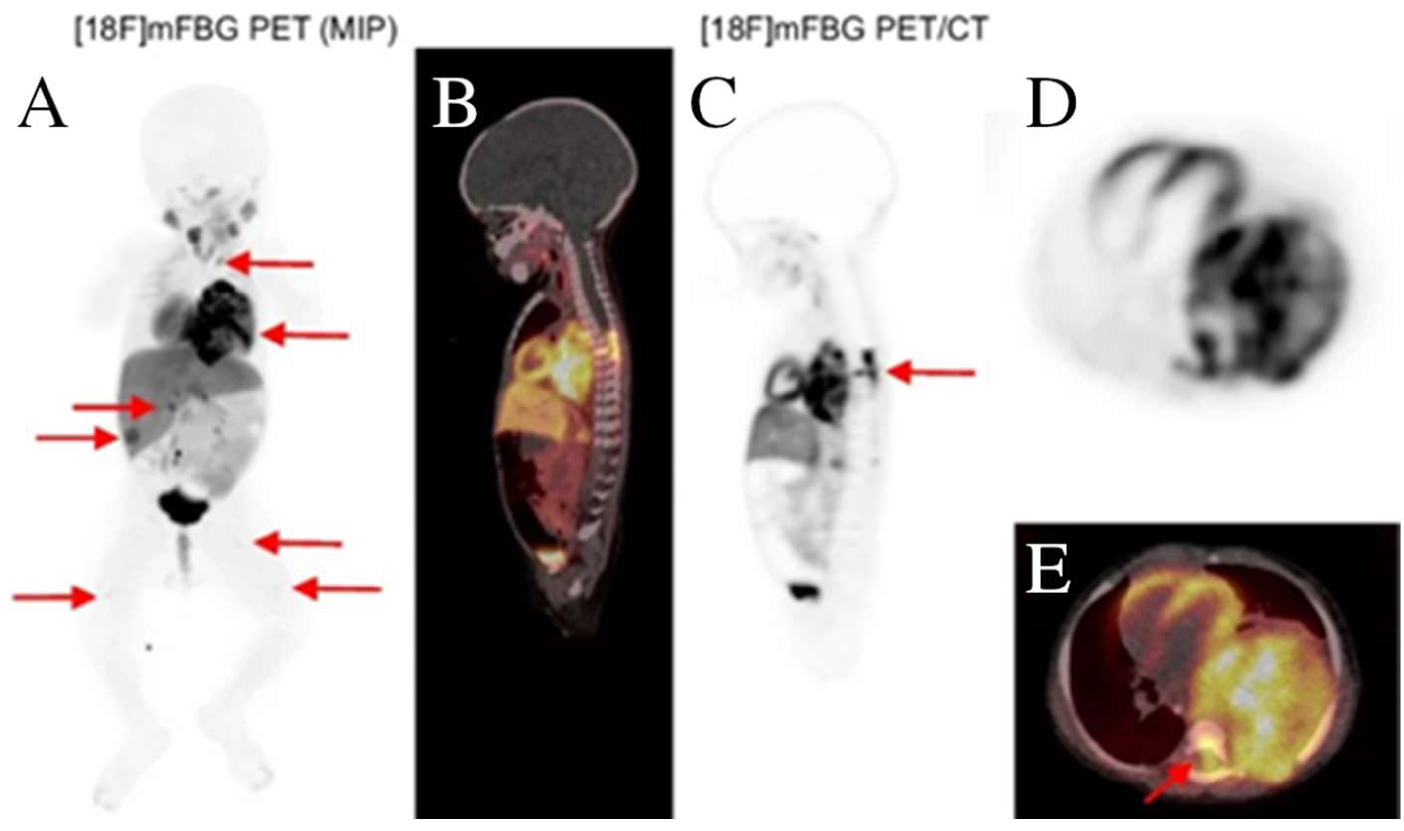 Cancers 15 05173 g004