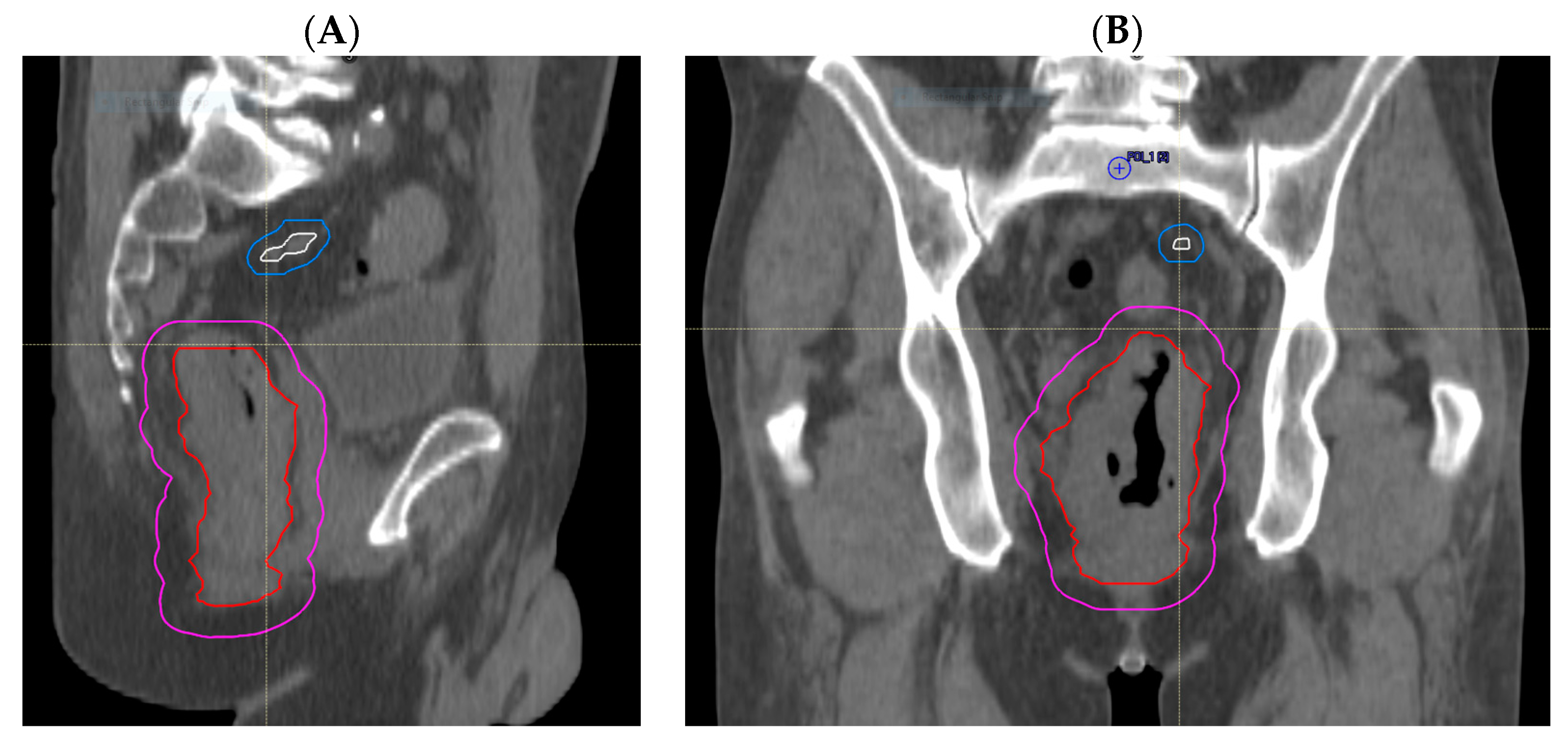 Cancers 15 05176 g002