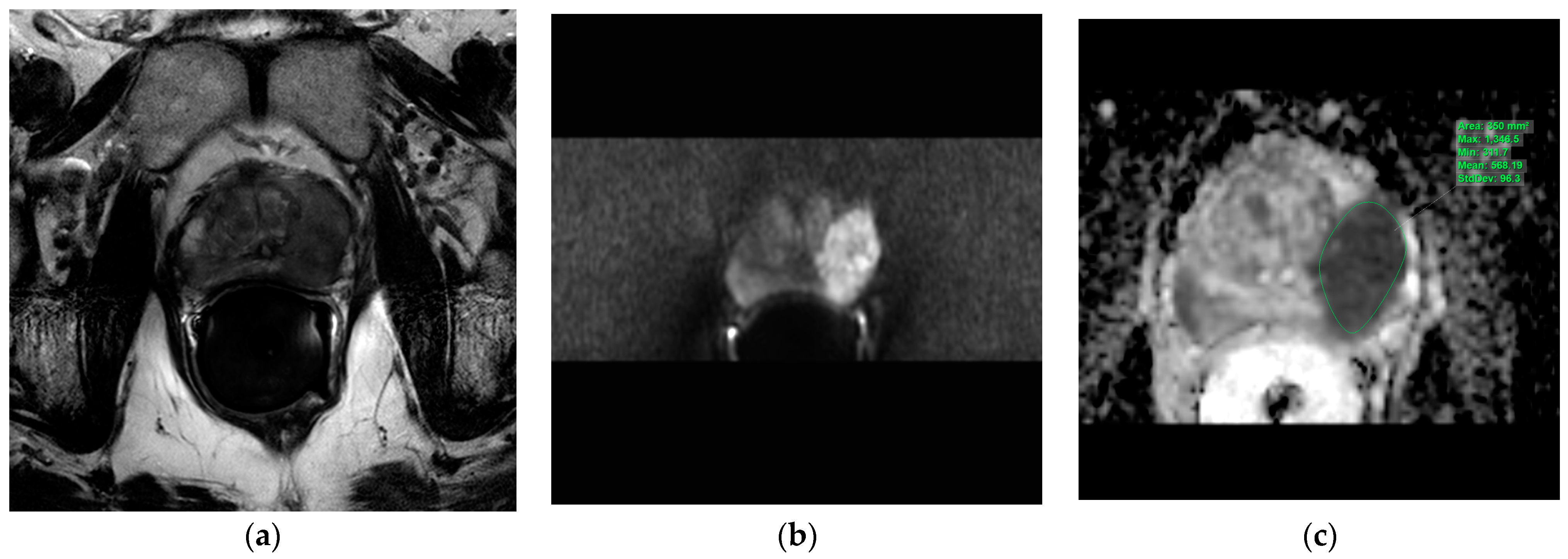 Cancers 15 05183 g001