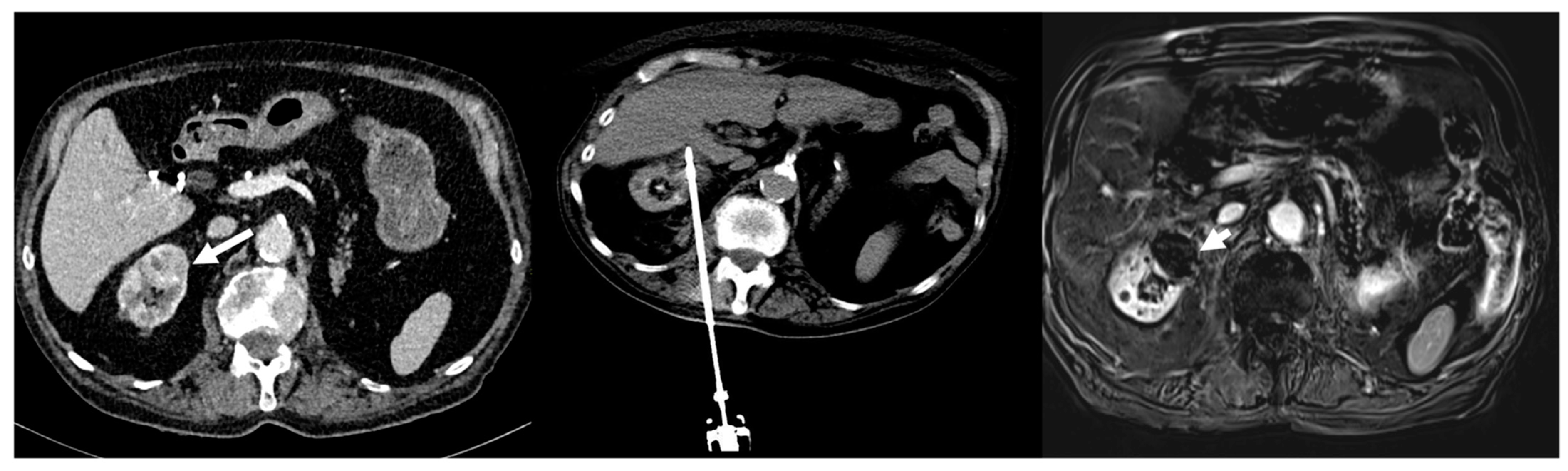 Cancers 15 05192 g002