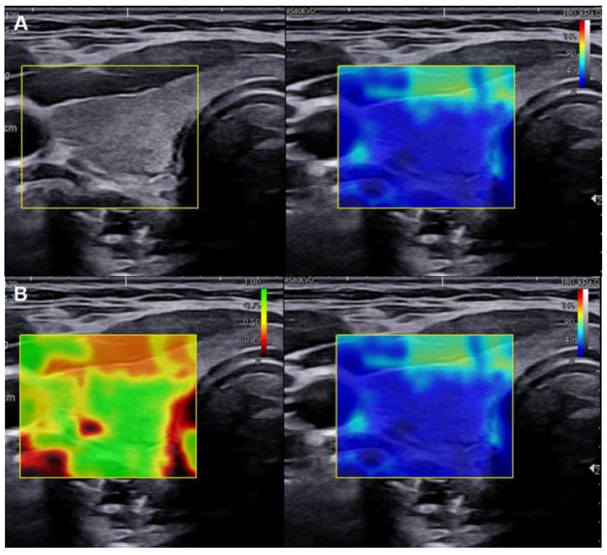 Cancers 15 05214 g002a