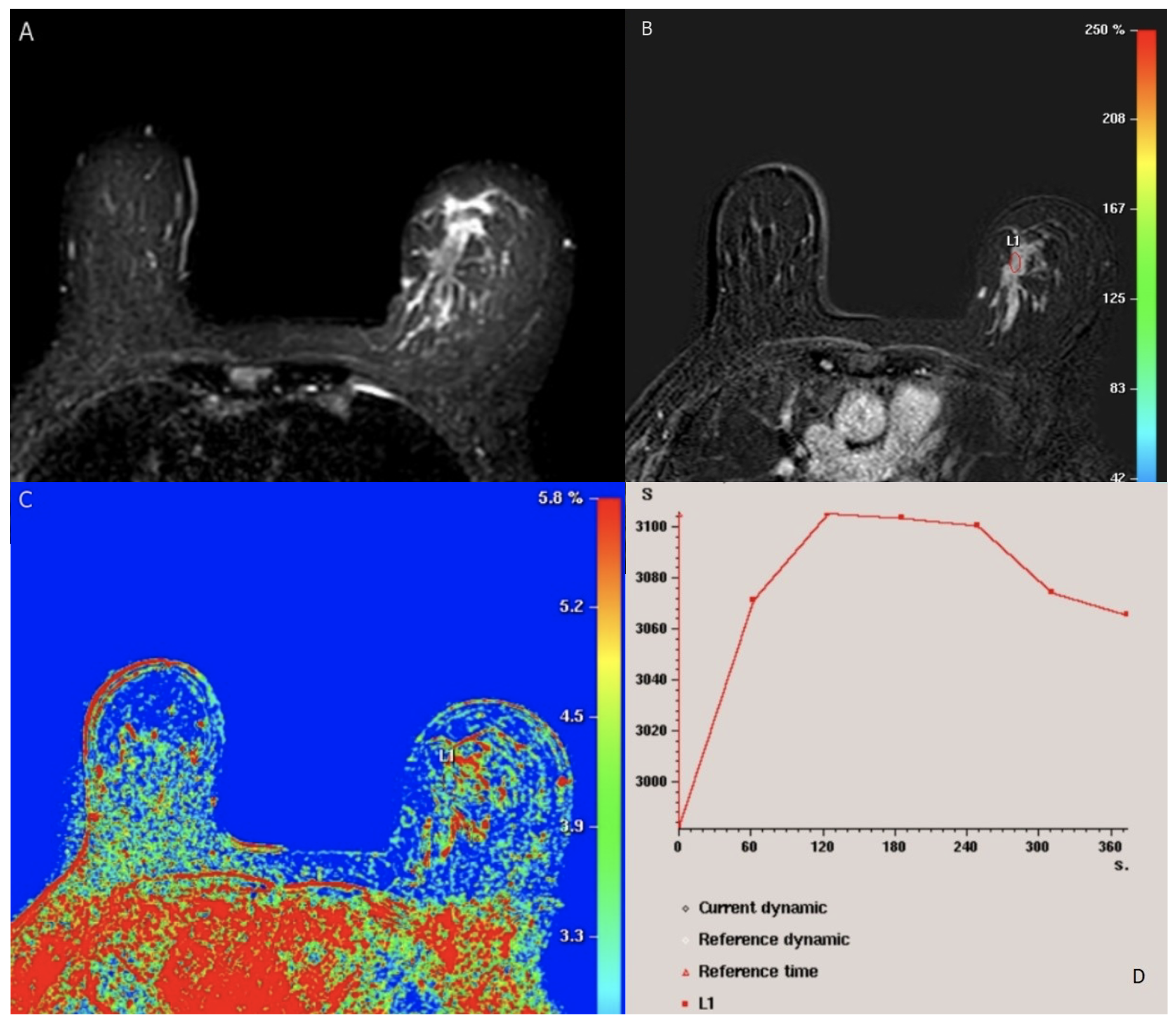 Cancers 15 05216 g002 Cancers 15 05216 g002