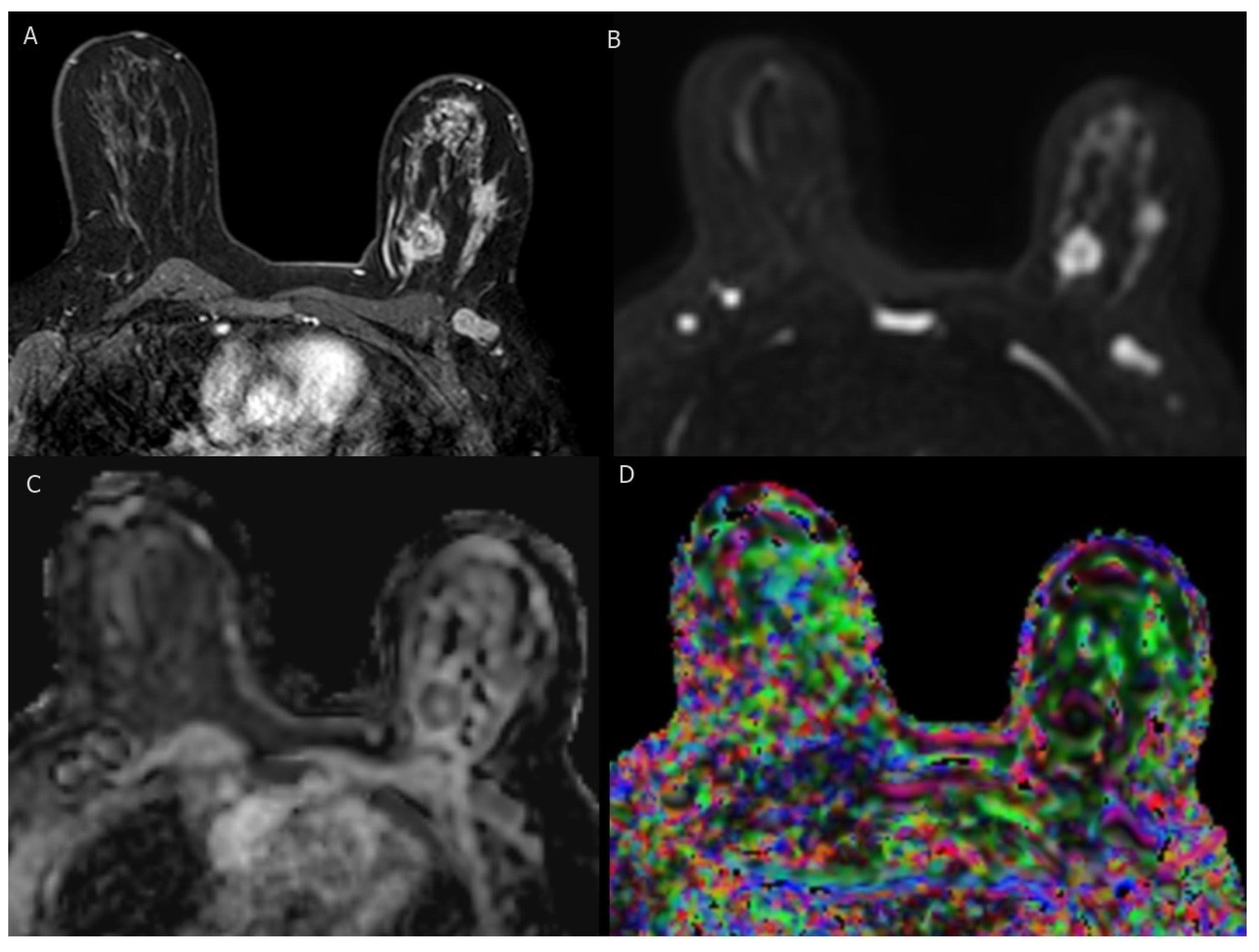 Cancers 15 05216 g003 Cancers 15 05216 g003