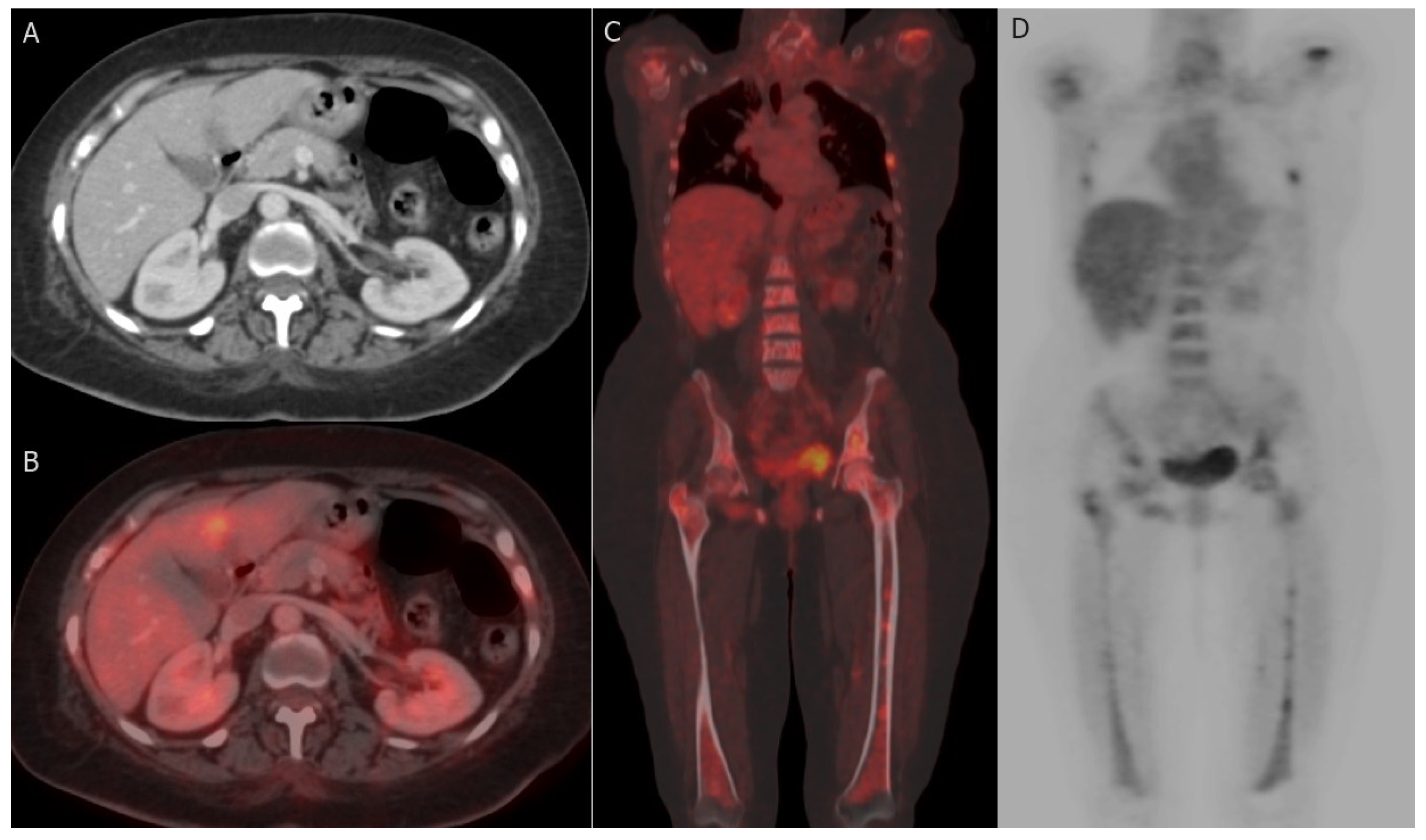 Cancers 15 05216 g005 Cancers 15 05216 g005