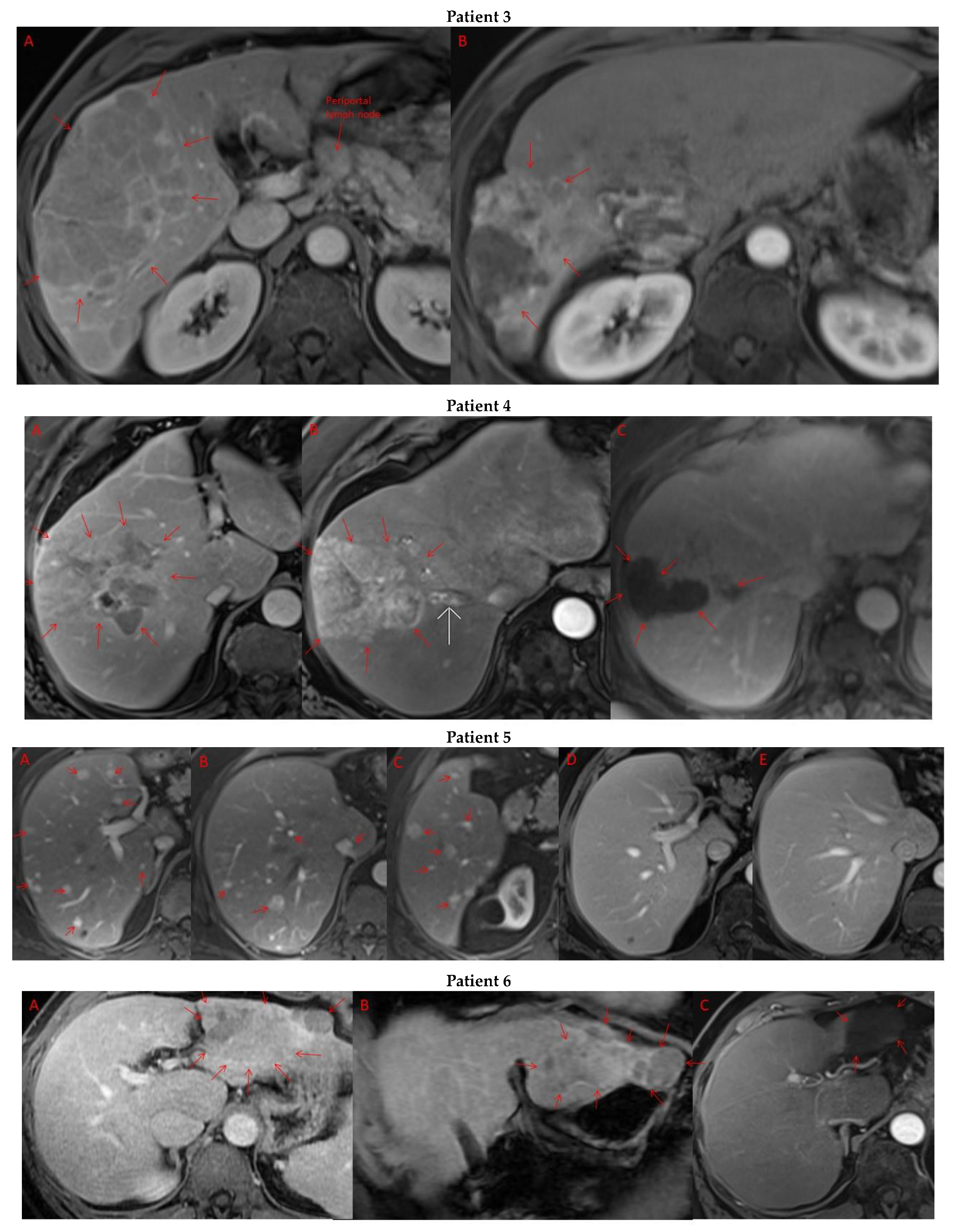 Cancers 15 05220 g003b