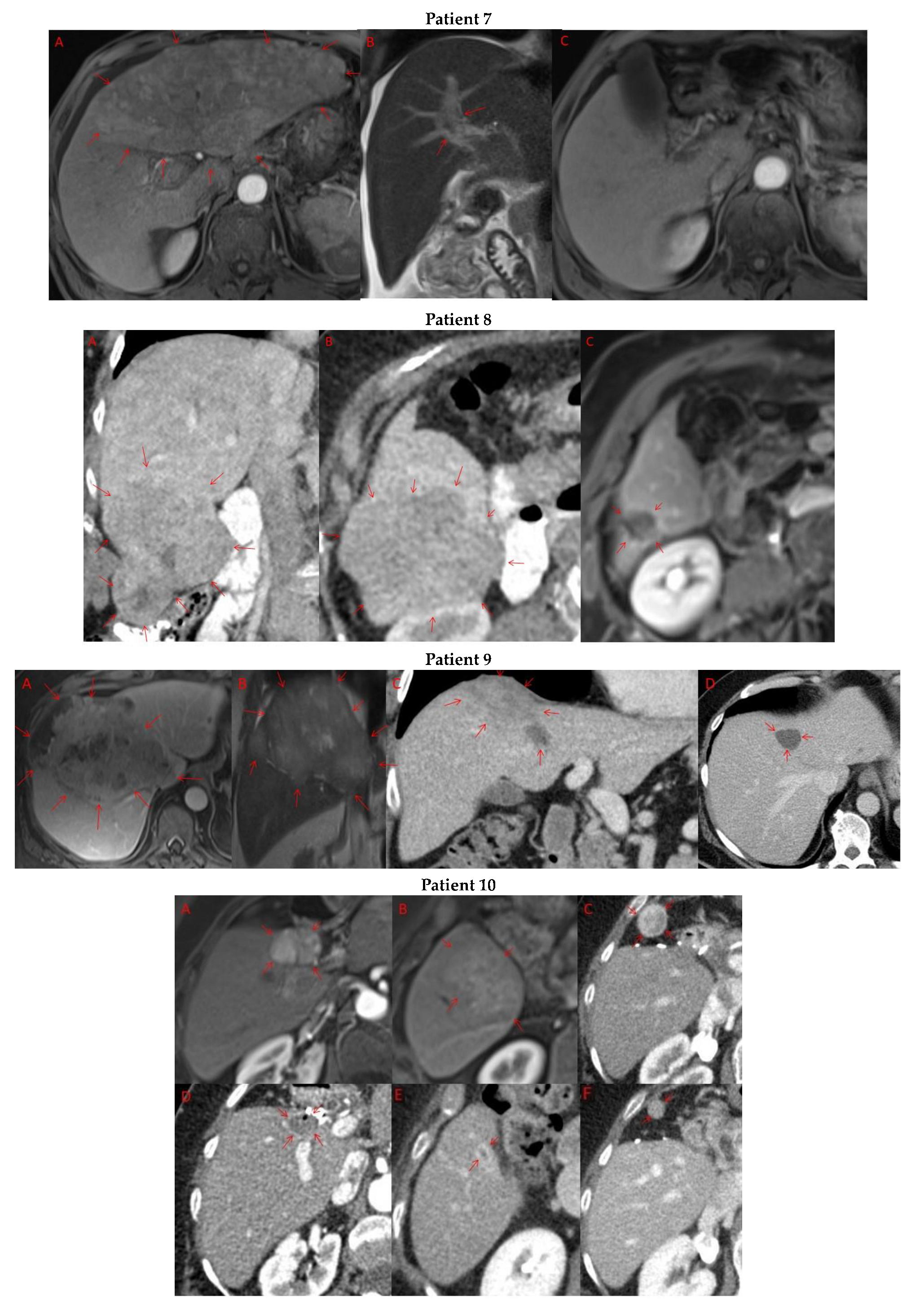 Cancers 15 05220 g003c