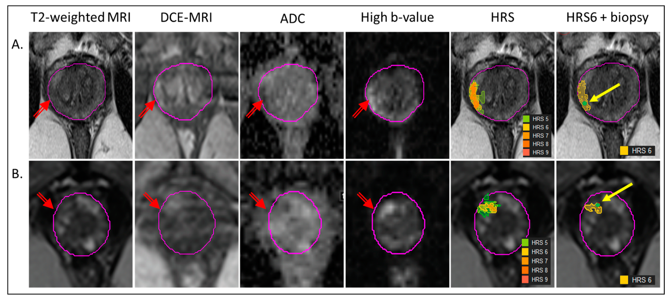 Cancers 15 05240 g001