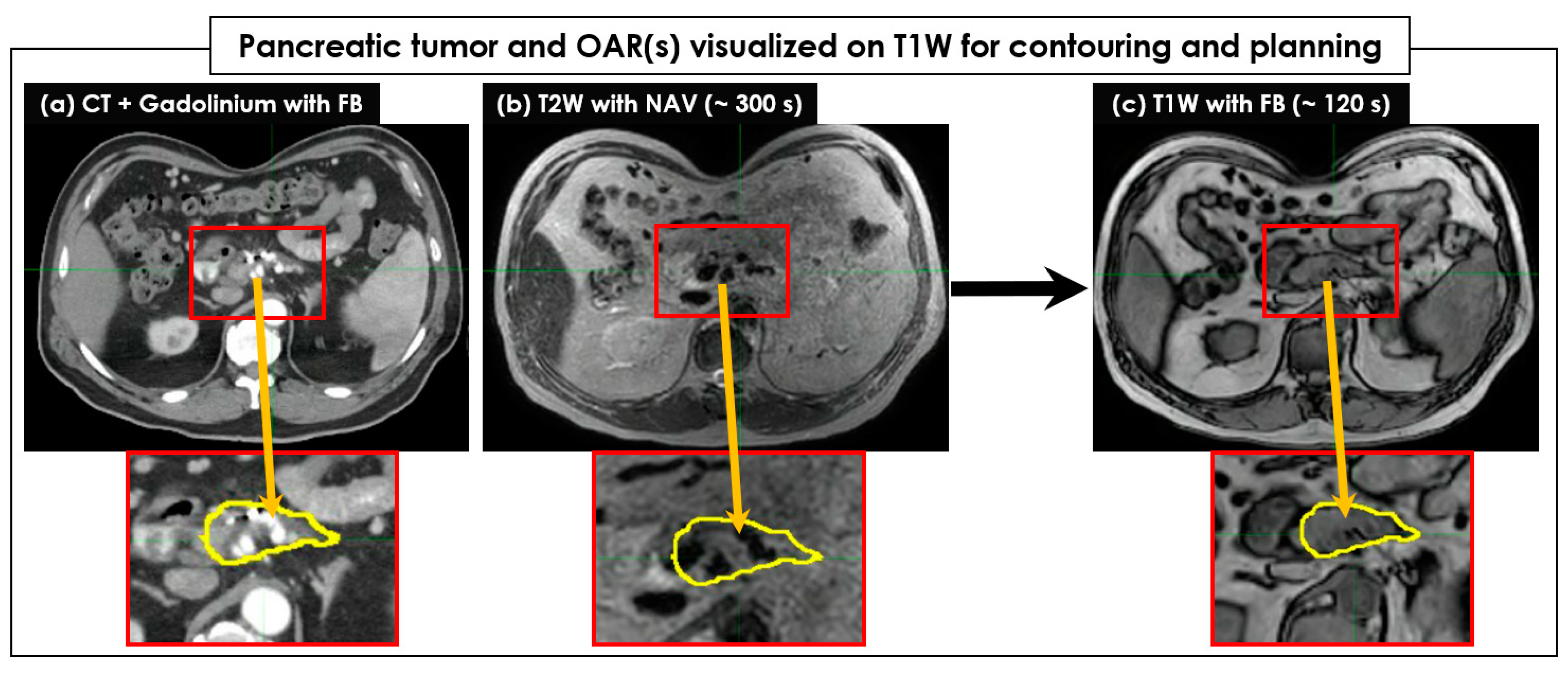 Cancers 15 05272 g002