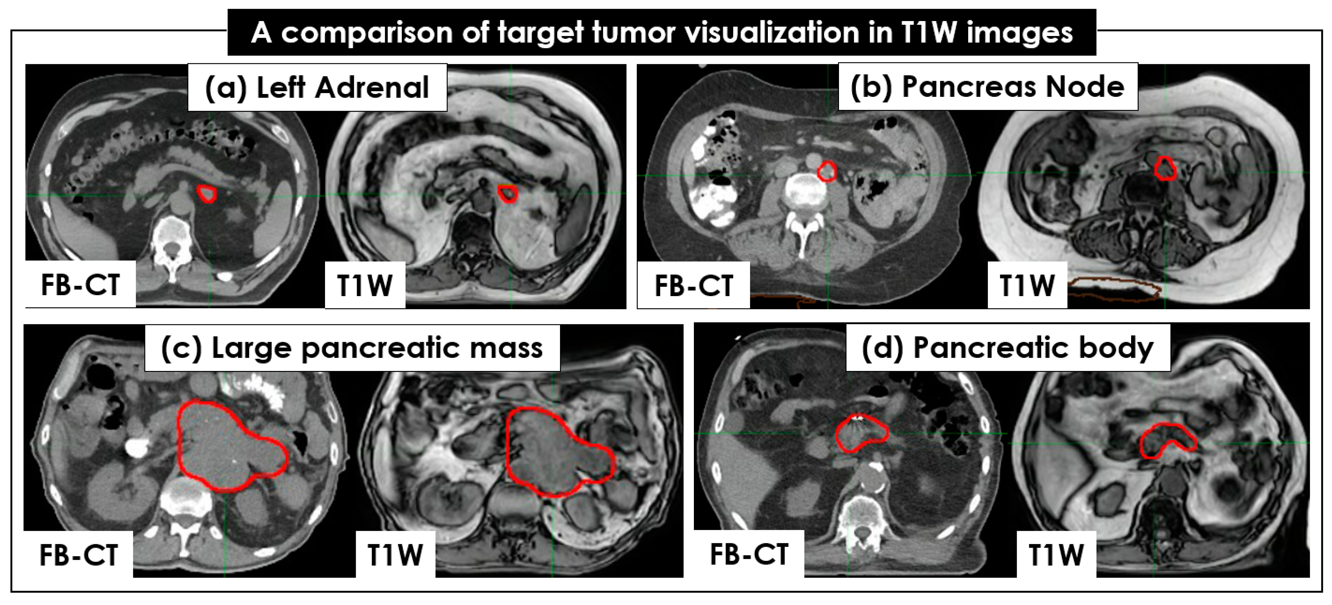 Cancers 15 05272 g003