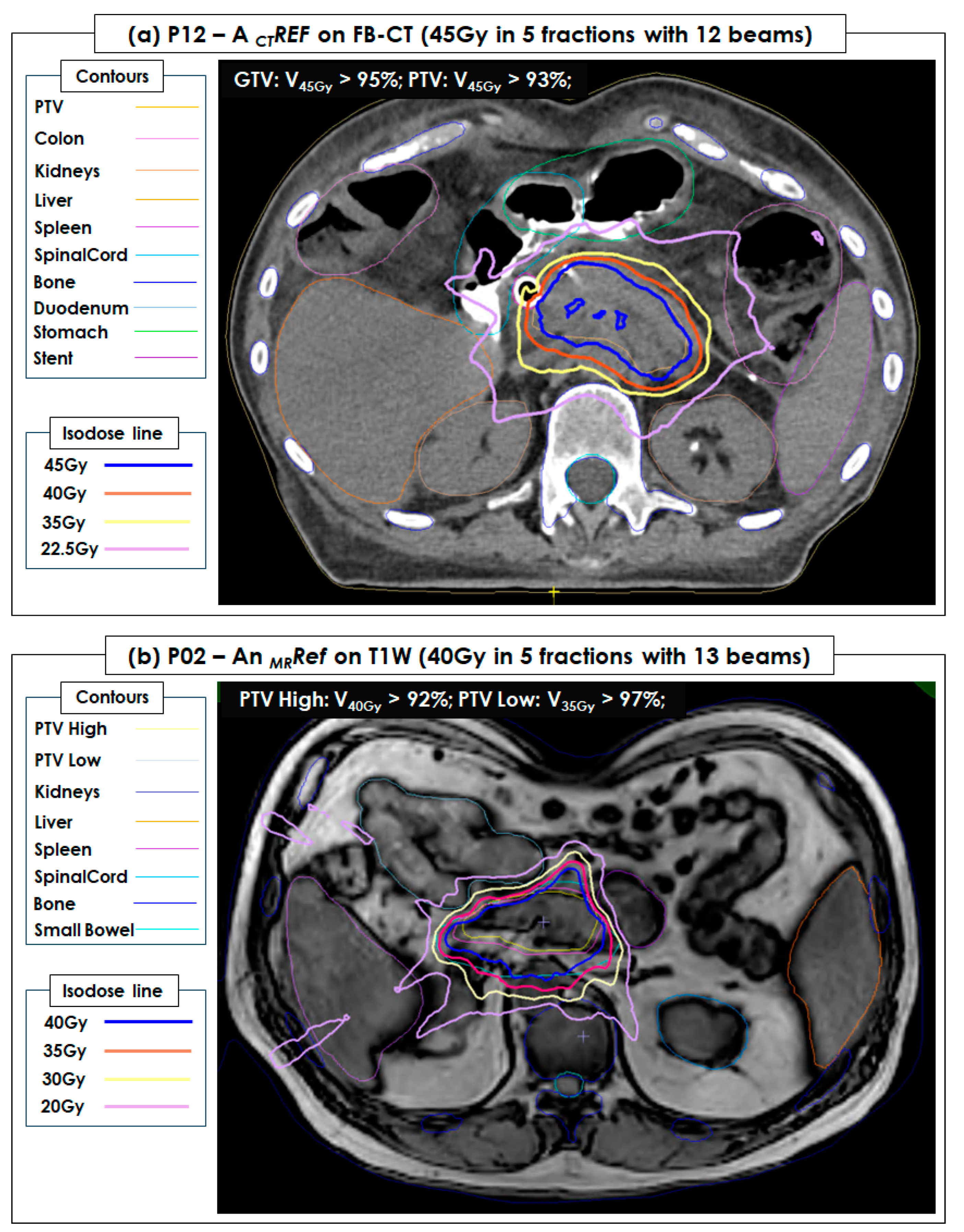 Cancers 15 05272 g004
