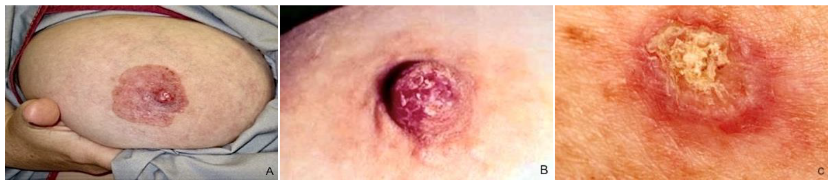 Cancers 15 05276 g003