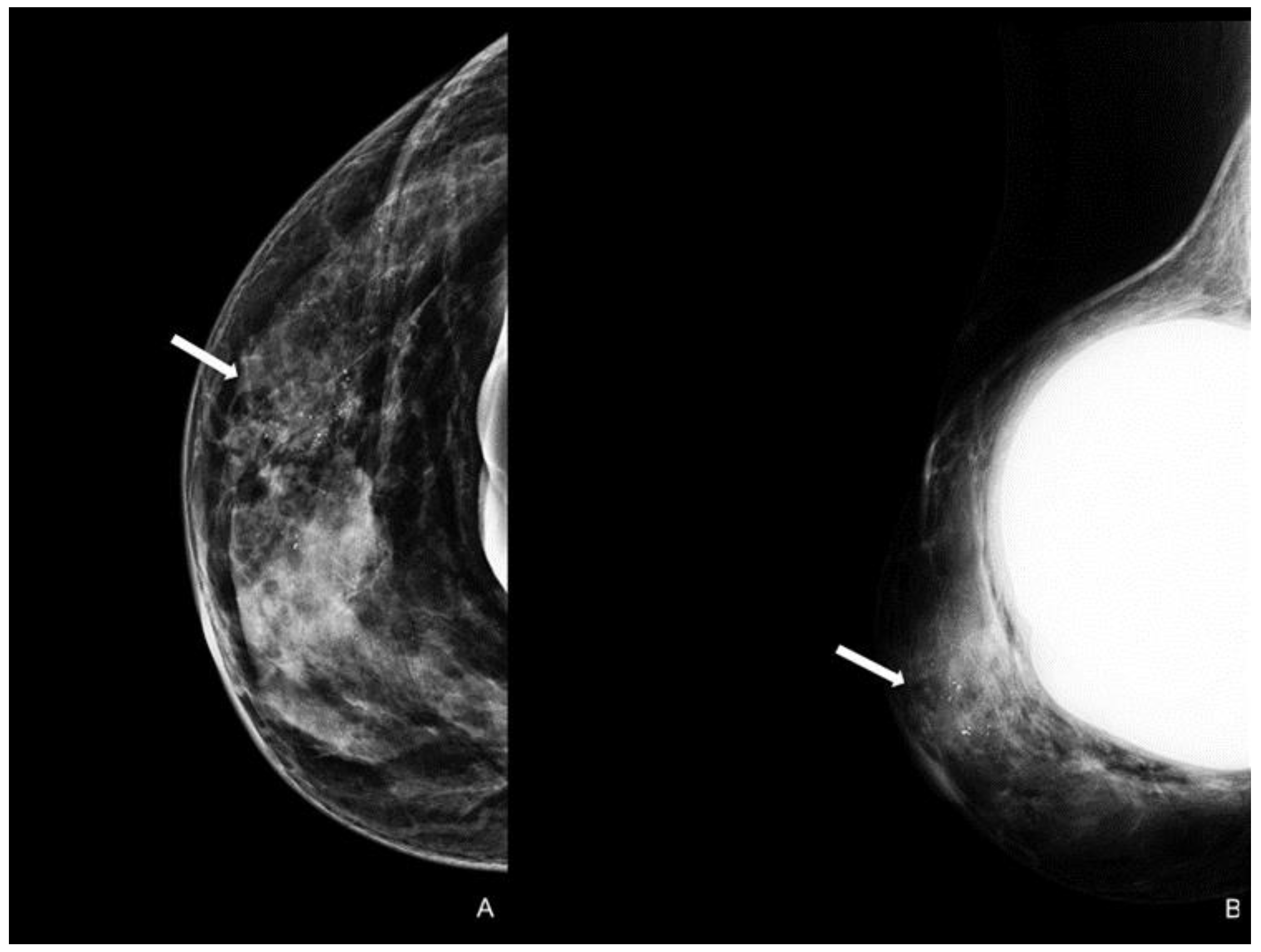 Cancers 15 05276 g004