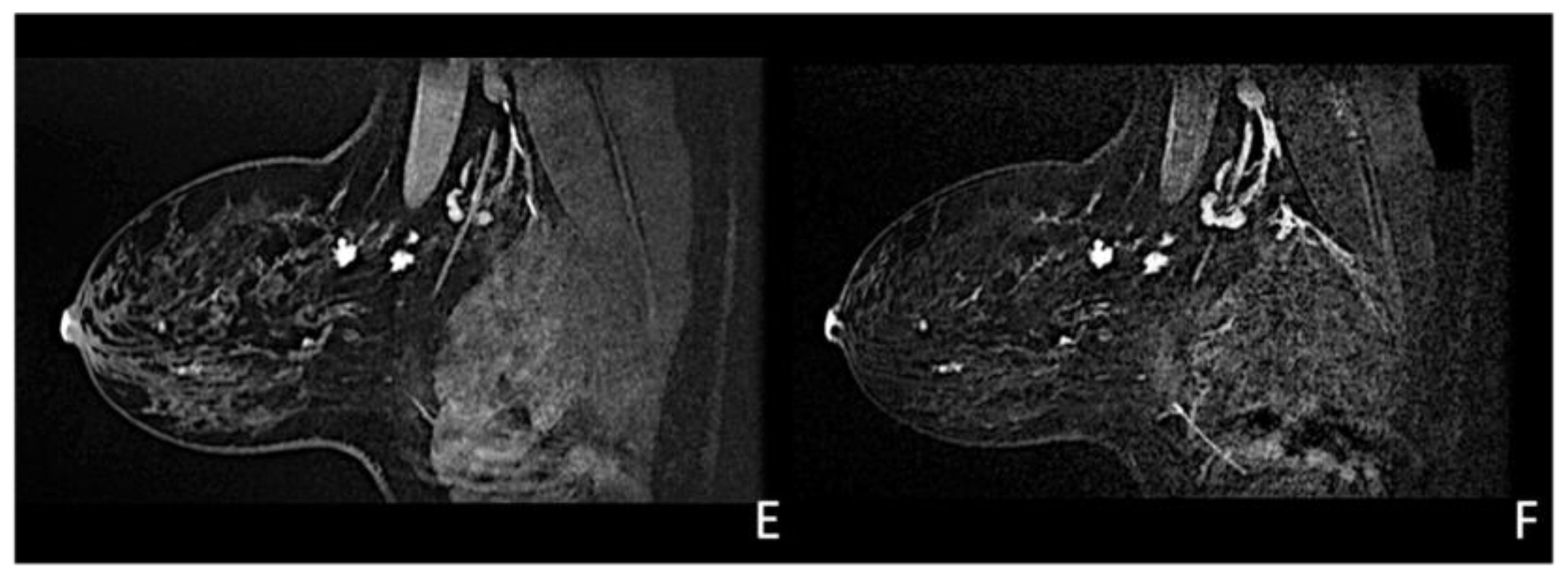 Cancers 15 05276 g006b