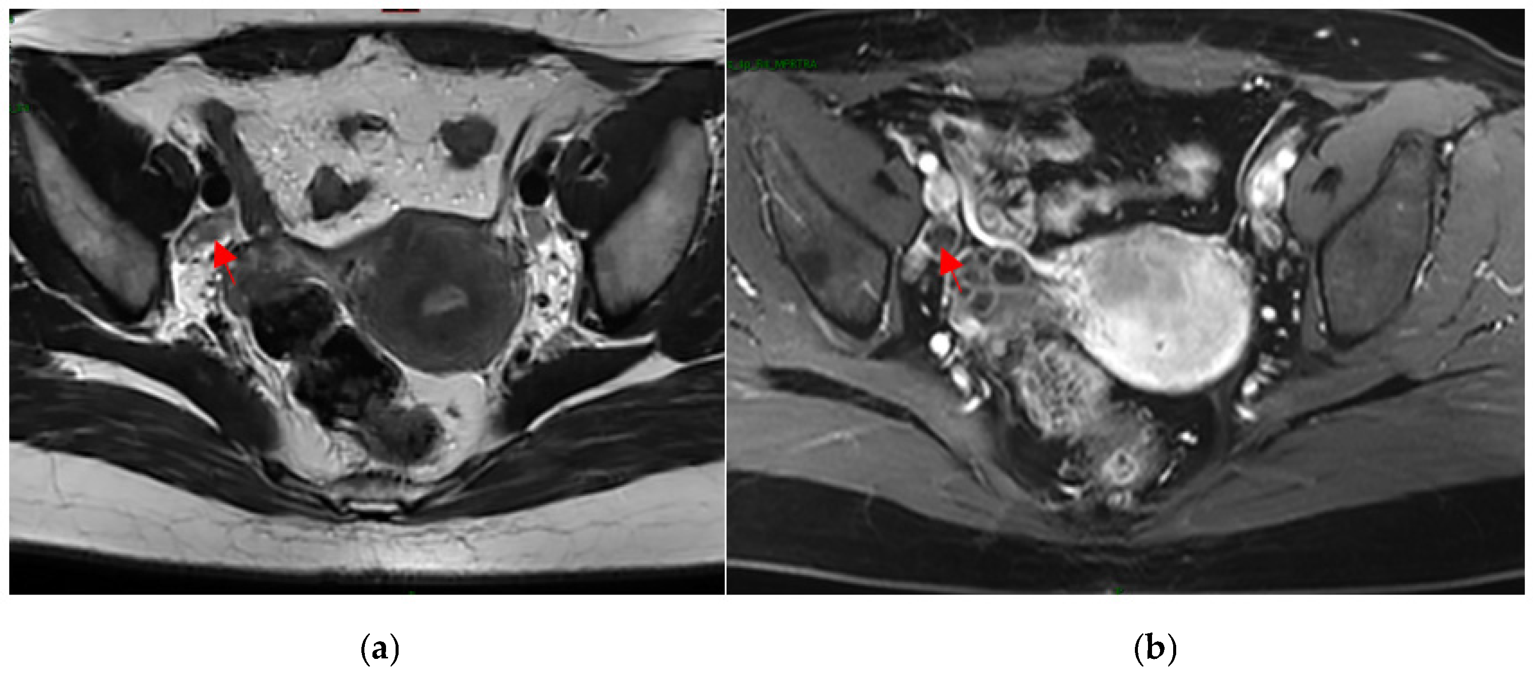 Cancers 15 05281 g001