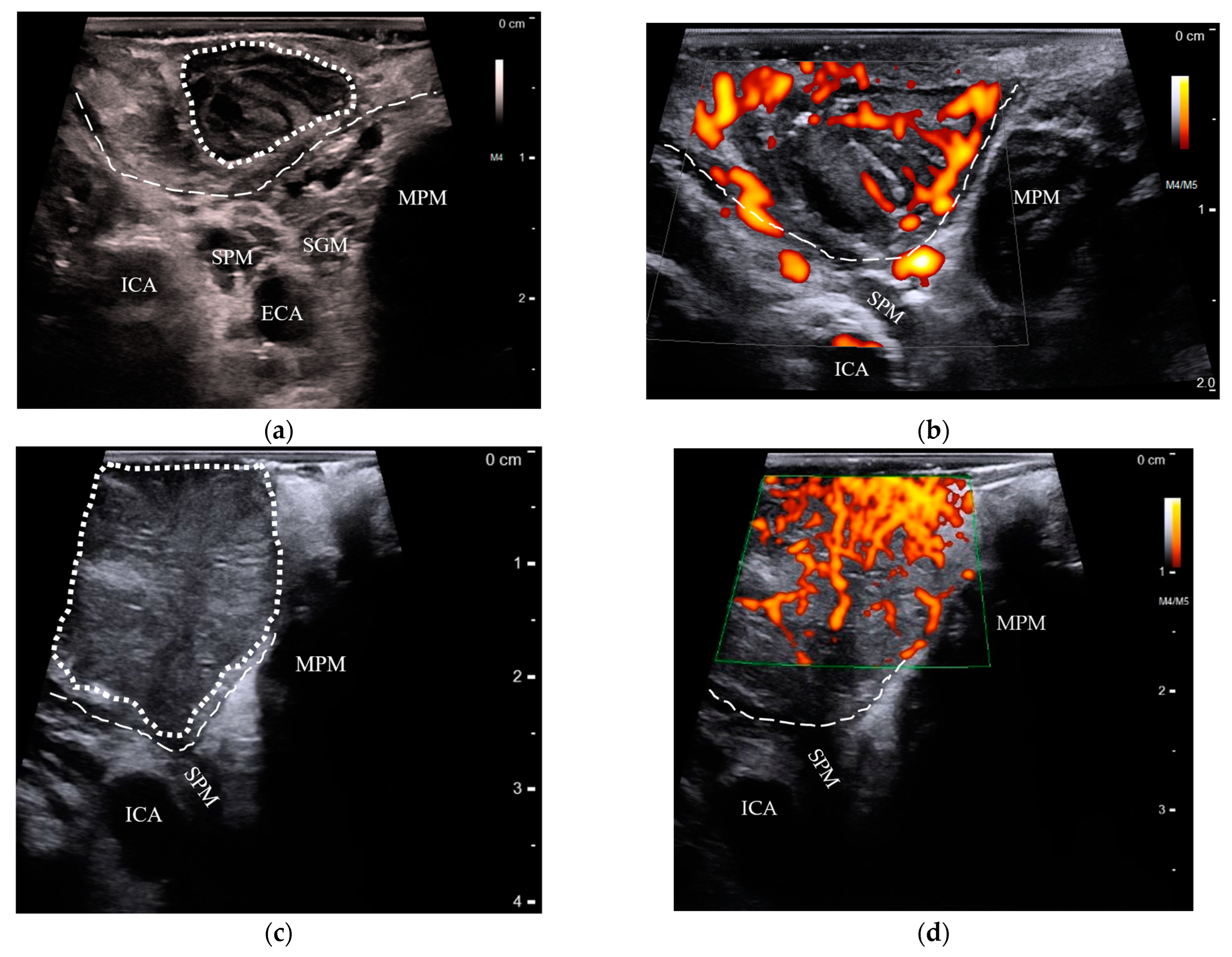 Cancers 15 05292 g002