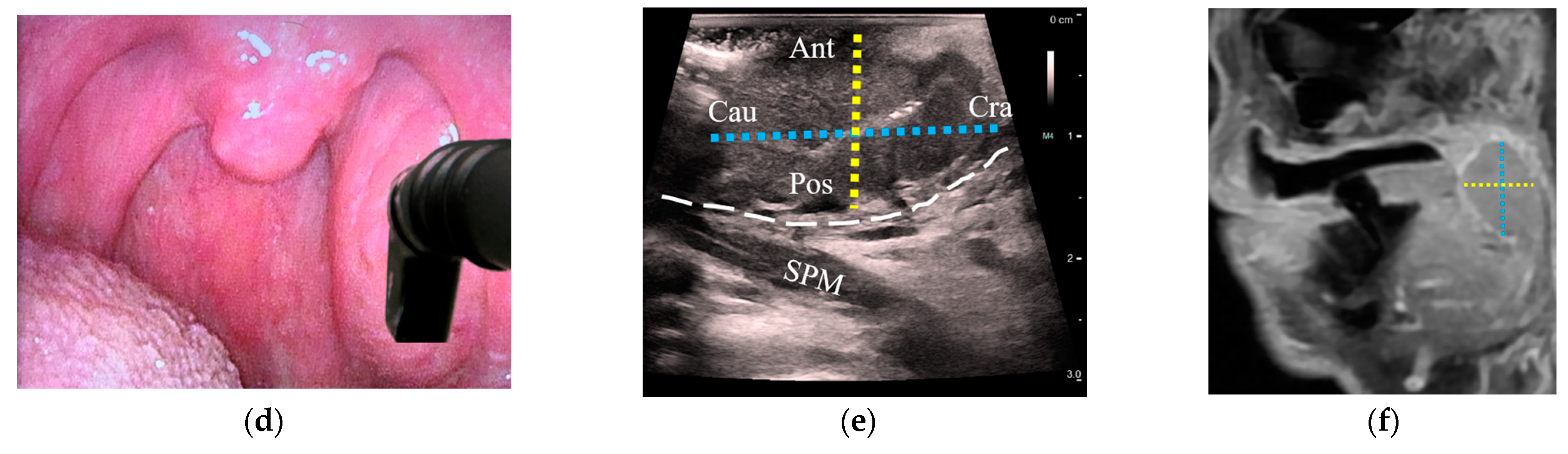 Cancers 15 05292 g004b
