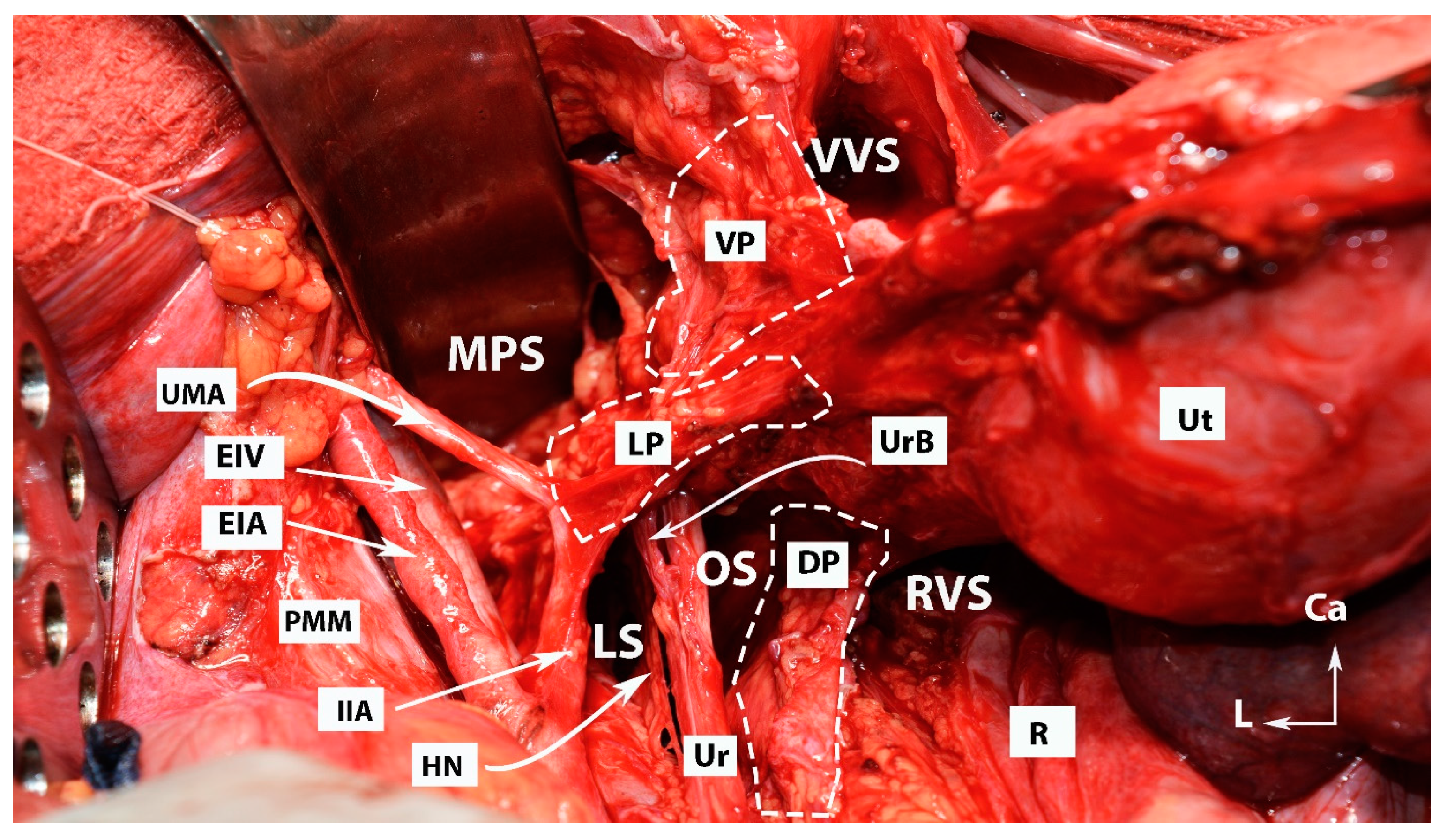 Cancers 15 05295 g001