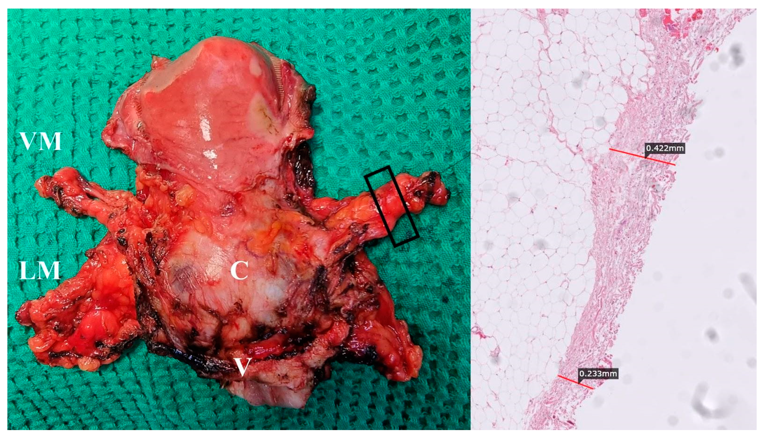 Cancers 15 05295 g008