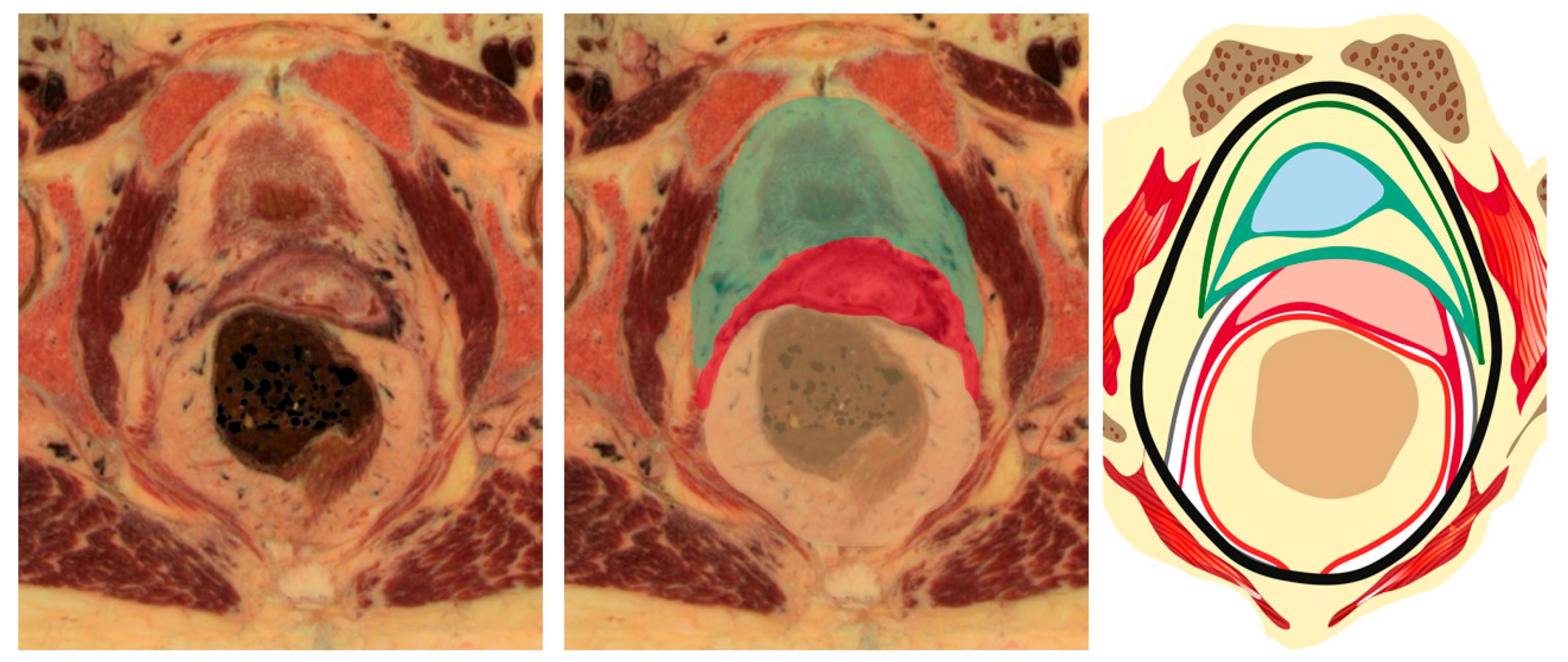 Cancers 15 05295 g009