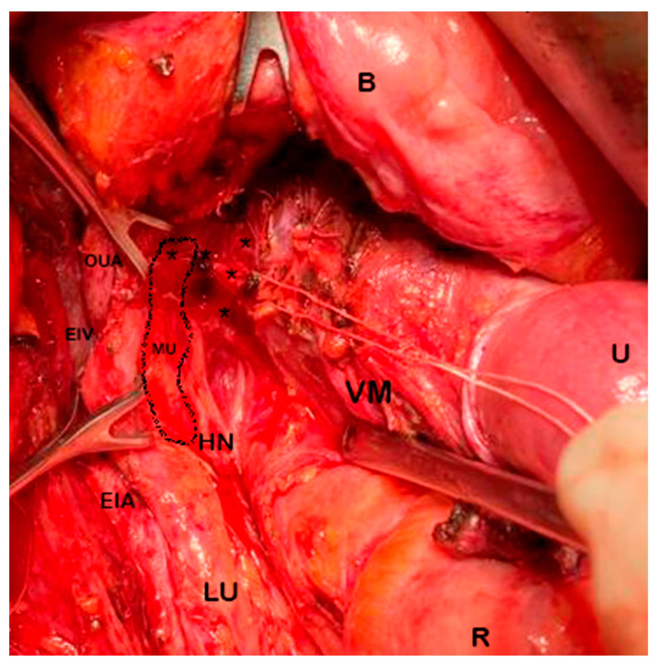 Cancers 15 05295 g011