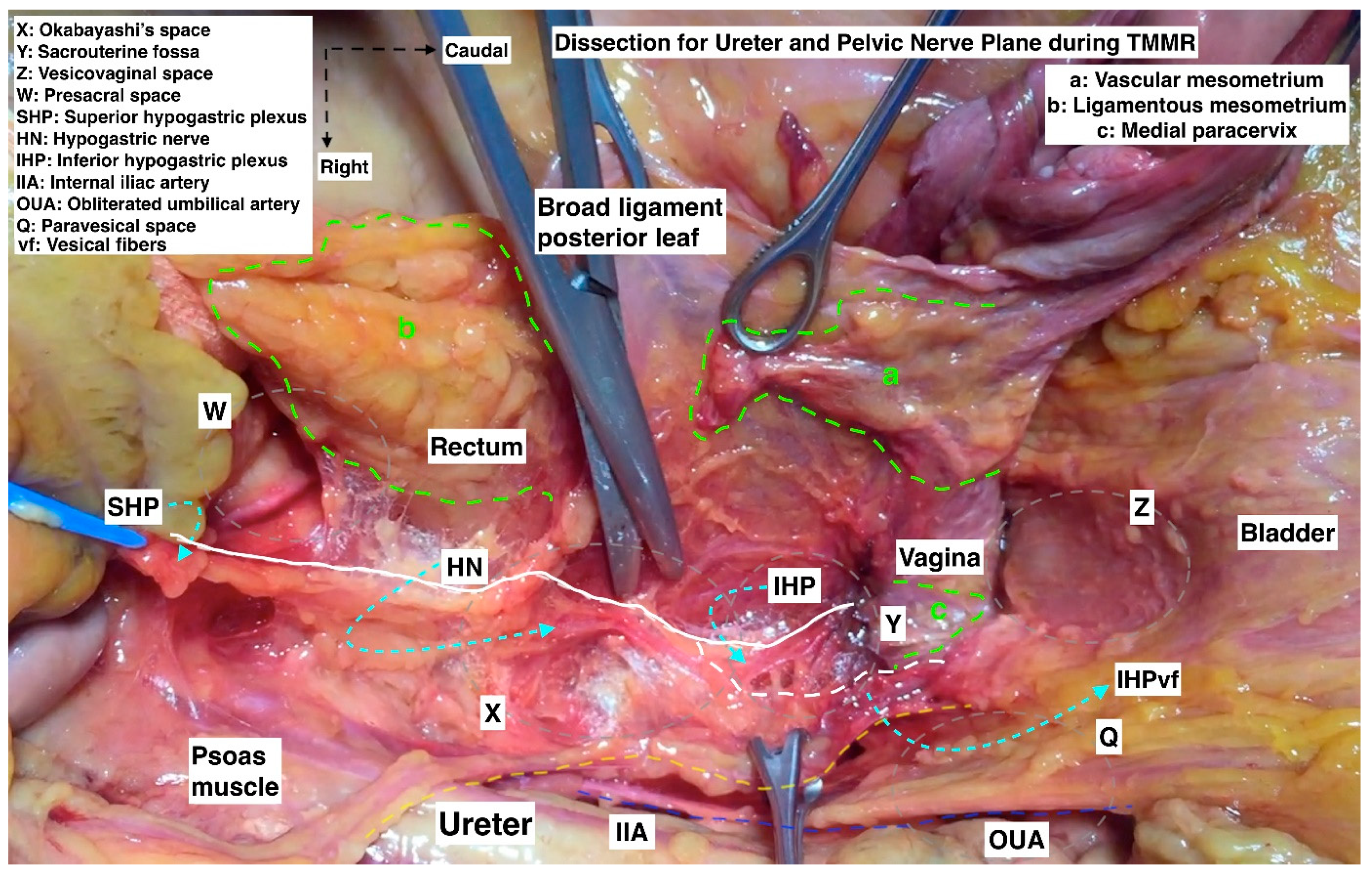 Cancers 15 05295 g012