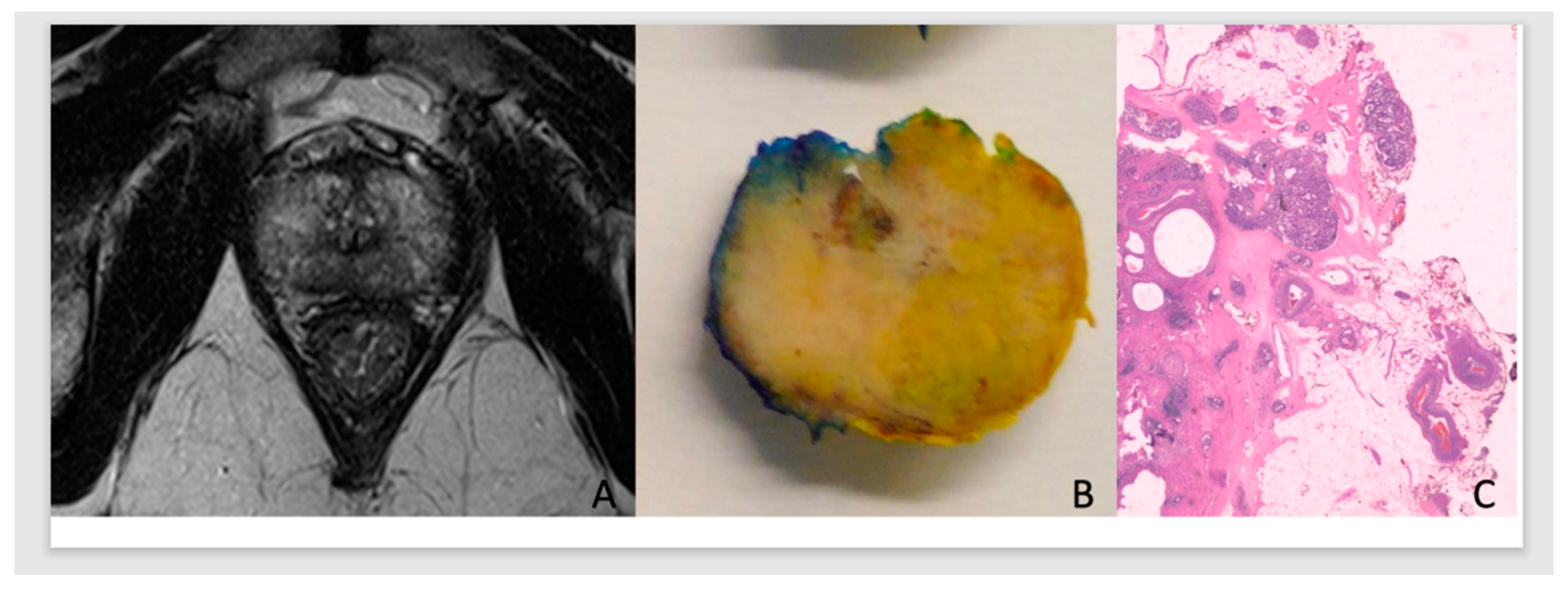 Cancers 15 05296 g001