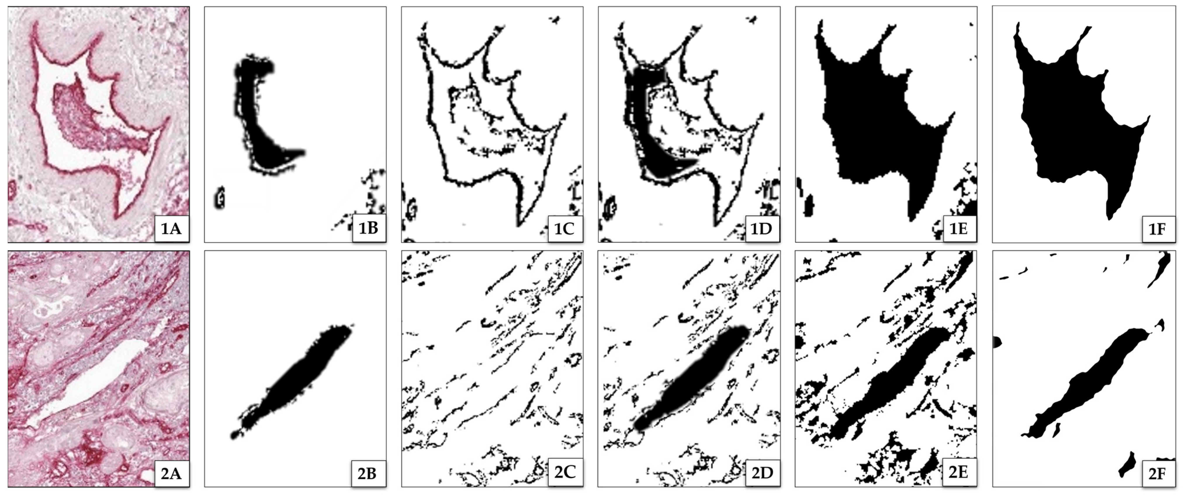 Cancers 15 05352 g004 Cancers 15 05352 g004