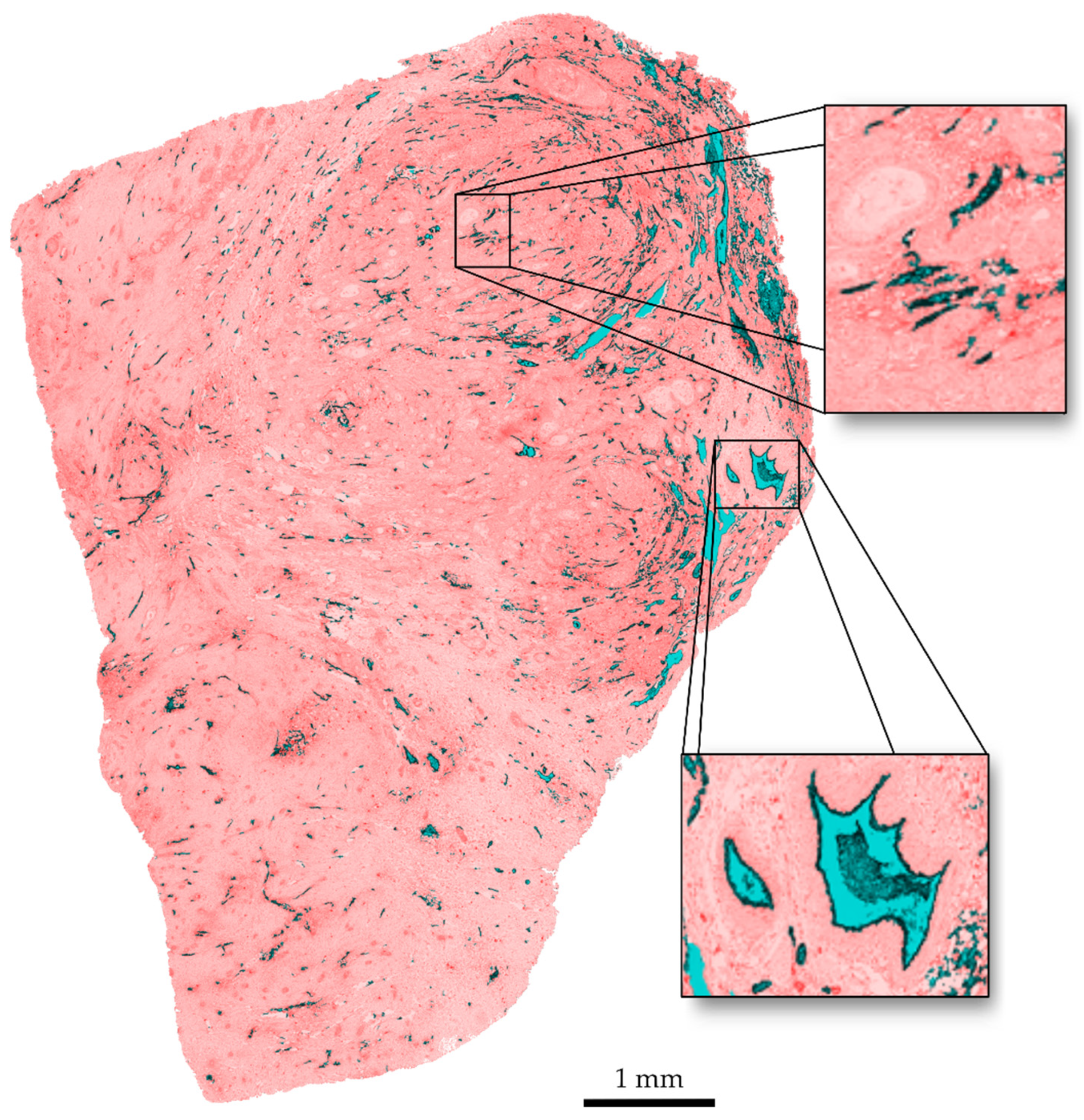 Cancers 15 05352 g007 Cancers 15 05352 g007